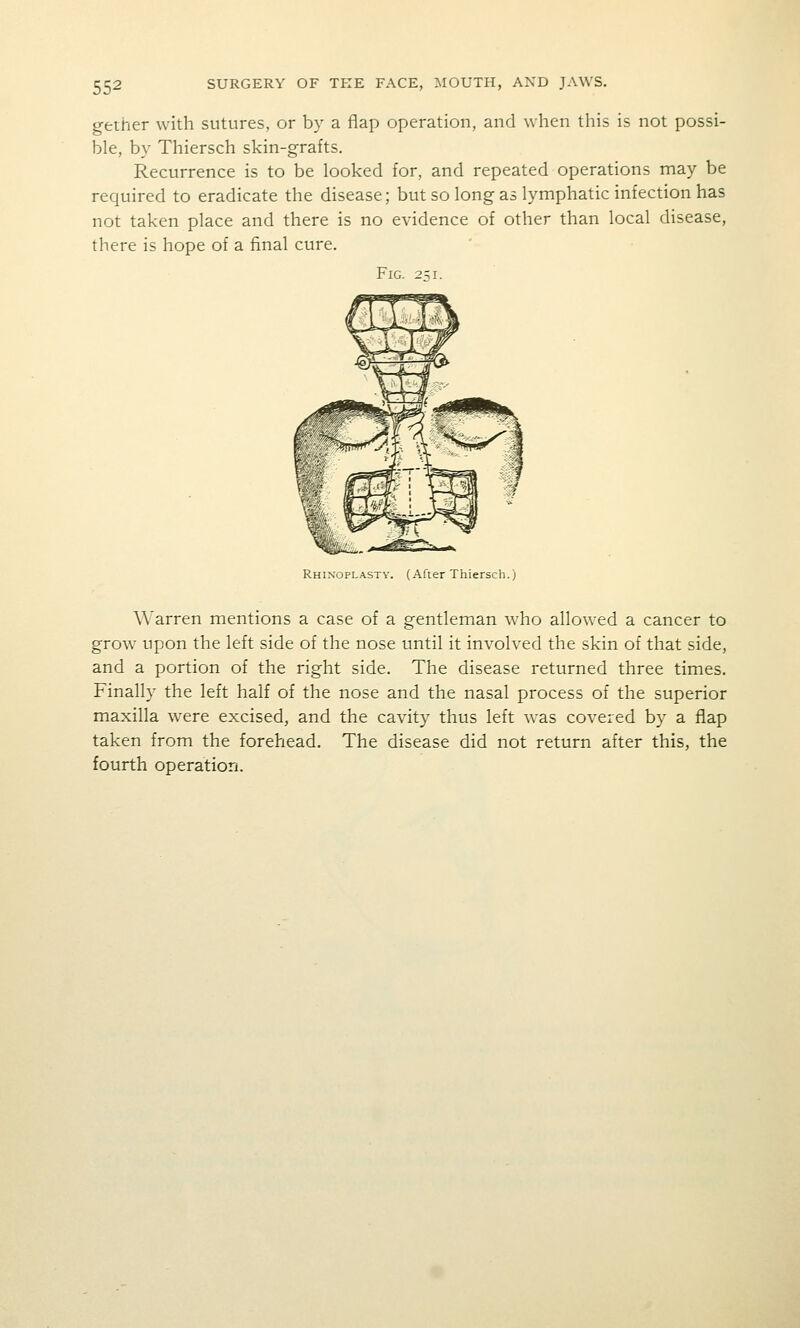 gether with sutures, or by a flap operation, and when this is not possi- ble, by Thiersch skin-grafts. Recurrence is to be looked for, and repeated operations may be required to eradicate the disease; but so long as lymphatic infection has not taken place and there is no evidence of other than local disease, there is hope of a final cure. Fig. 2;i. Rhinoplasty. (After Thiersch.) Warren mentions a case of a gentleman who allowed a cancer to grow upon the left side of the nose until it involved the skin of that side, and a portion of the right side. The disease returned three times. Finally the left half of the nose and the nasal process of the superior maxilla were excised, and the cavity thus left was covered by a flap taken from the foretiead. The disease did not return after this, the fourth operation.