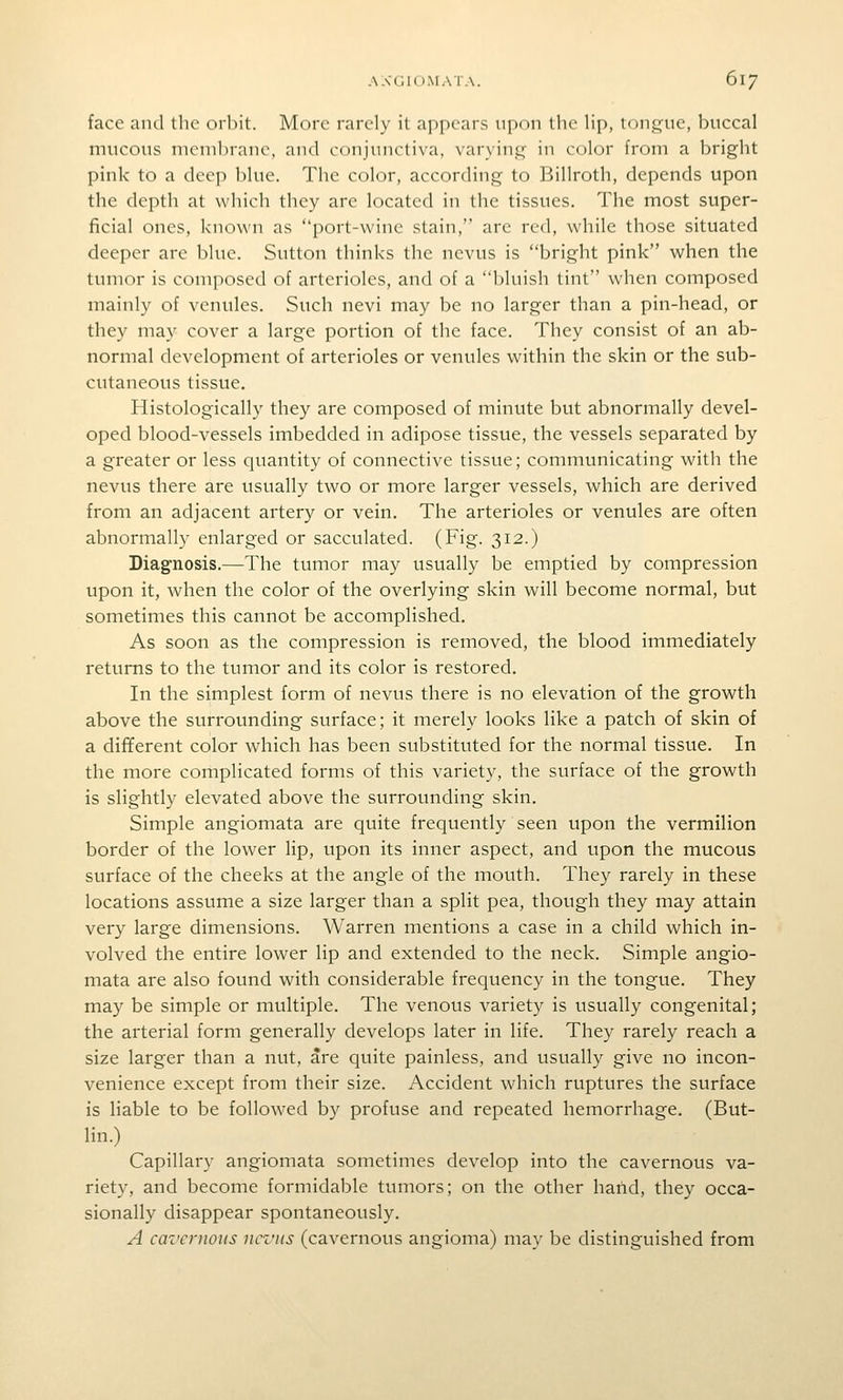 face and the orbit. More rarely it appears upon the hp, tongue, buccal mucous membrane, and conjunctiva, varying in color from a bright pink to a deep blue. The color, according to Billroth, depends upon the depth at which they are located in the tissues. The most super- ficial ones, known as port-wine stain, are red, while those situated deeper are blue. Sutton thinks the nevus is bright pink when the tumor is composed of arterioles, and of a bluish tint when composed mainly of venules. Such nevi may be no larger than a pin-head, or they may cover a large portion of the face. They consist of an ab- normal development of arterioles or venules within the skin or the sub- cutaneous tissue. Histologically they are composed of minute but abnormally devel- oped blood-vessels imbedded in adipose tissue, the vessels separated by a greater or less quantity of connective tissue; communicating with the nevus there are usually two or more larger vessels, which are derived from an adjacent artery or vein. The arterioles or venules are often abnormally enlarged or sacculated. (Fig. 312.) Diagnosis.—The tumor may usually be emptied by compression upon it, when the color of the overlying skin will become normal, but sometimes this cannot be accomplished. As soon as the compression is removed, the blood immediately returns to the tumor and its color is restored. In the simplest form of nevus there is no elevation of the growth above the surrounding surface; it merely looks like a patch of skin of a different color which has been substituted for the normal tissue. In the more complicated forms of this variety, the surface of the growth is slightly elevated above the surrounding skin. Simple angiomata are quite frequently seen upon the vermilion border of the lower lip, upon its inner aspect, and upon the mucous surface of the cheeks at the angle of the mouth. They rarely in these locations assume a size larger than a split pea, though they may attain very large dimensions. Warren mentions a case in a child which in- volved the entire lower lip and extended to the neck. Simple angio- mata are also found with considerable frequency in the tongue. They may be simple or multiple. The venous variety is usually congenital; the arterial form generally develops later in life. They rarely reach a size larger than a nut, are quite painless, and usually give no incon- venience except from their size. Accident which ruptures the surface is liable to be followed by profuse and repeated hemorrhage. (But- lin.) Capillary angiomata sometimes develop into the cavernous va- riety, and become formidable tumors; on the other hand, they occa- sionally disappear spontaneously. A cavernous nevus (cavernous angioma) may be distinguished from