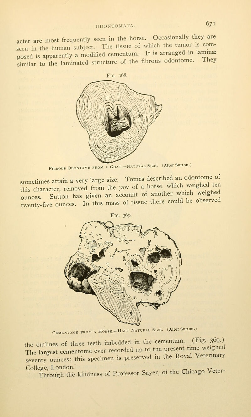 acter are most frequently seen in the horse. Occasionally they are seen in the human subject. The tissue of which the tumor is com- posed is apparently a modified cementum. It is arranged m lammae similar to the laminated structure of the fibrous odontome. They Fig. .-^68. M A Goat.-Natural Size. (After Sutton.) Fibrous Odontome fro sometimes attain a very large size. Tomes described an odontome of tliis character, removed from the jaw of a horse, which weighed ten ounces. Sutton has given an account of another wh.ch weighed twenty-five ounces. In this mass of tissue there could be observed Fig. 369. „^>, A HoRSF—Half Natural Size. (After Sutton.) Cementome from a horse. riALi^ ii«.iu the outlines of three teeth imbedded in the cementum. (Fig. 369-) The largest cementome ever recorded up to the present time weighed seventy ounces; this specimen is preserved in the Royal Vetermary Collesre, London. ^ ^, . ^^ ^ Through the kindness of Professor Sayer, of the Chicago Veter-