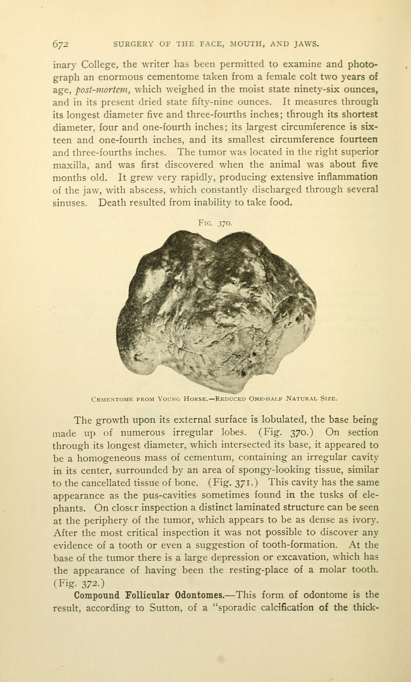 inary College, the writer has been permitted to examine and photo- graph an enormous cementome taken from a female colt two years of age, post-mortem, which weighed in the moist state ninety-six ounces, and in its present dried state fifty-nine ounces. It measures through its longest diameter five and three-fourths inches; through its shortest diameter, four and one-fourth inches; its largest circumference is six- teen and one-fourth inches, and its smallest circumference fourteen and three-fourths inches. The tumor was located in the right superior maxilla, and was first discovered when the animal was about five months old. It grew very rapidly, producing extensive inflammation of the jaw, with abscess, which constantly discharged through several sinuses. Death resulted from inability to take food. Fig. 370. Cementome from Young Horse.—Reduced One-half Natural Size. The growth upon its external surface is lobulated, the base being made up of numerous irregular lobes. (Fig. 370.) On section through its longest diameter, which intersected its base, it appeared to be a homogeneous mass of cementum, containing an irregular cavity in its center, surrounded by an area of spongy-looking tissue, similar to the cancellated tissue of bone. (Fig. 371.) This cavity has the same appearance as the pus-cavities sometimes found in the tusks of ele- phants. On closer inspection a distinct laminated structure can be seen at the periphery of the tumor, which appears to be as dense as ivory. After the most critical inspection it was not possible to discover any evidence of a tooth or even a suggestion of tooth-formation. At the base of the tumor there is a large depression or excavation, which has the appearance of having been the resting-place of a molar tooth. (Fig. 372.) Compound Follicular Odontomes.—This form of odontome is the result, according to Sutton, of a sporadic calcification of the thick-