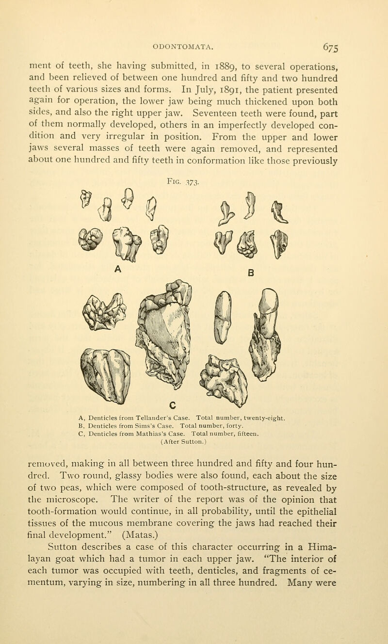 ment of teeth, she having submitted, in 1889, to several operations, and been relieved of between one hundred and fifty and two hundred teeth of various sizes and forms. In July, 1891, the patient presented again for operation, the lower jaw being much thickened upon both sides, and also the right upper jaw. Seventeen teeth were found, part of them normally developed, others in an imperfectly developed con- dition and very irregular in position. From the upper and lower jaws several masses of teeth were again removed, and represented about one hundred and fifty teeth in conformation like those previously Fig. T,y2,- A, Denticles from Tellander's Case. Total number, twenty-eight. B, Denticles from Sims's Case. Total number, forty. C, Denticles from Mathias's Case. Total number, fifteen. (After Sutton.) removed, making in all between three hundred and fifty and four hun- dred. Two round, glassy bodies were also found, each about the size of two peas, which were composed of tooth-structure, as revealed by the microscope. The writer of the report was of the opinion that tooth-formation would continue, in all probability, until the epithelial tissues of the mucous membrane covering the jaws had reached their final development. (Matas.) Sutton describes a case of this character occurring in a Hima- layan goat which had a tumor in each upper jaw. The interior of each tumor was occupied with teeth, denticles, and fragments of ce- mentum, varying in size, numbering in all three hundred. Many were