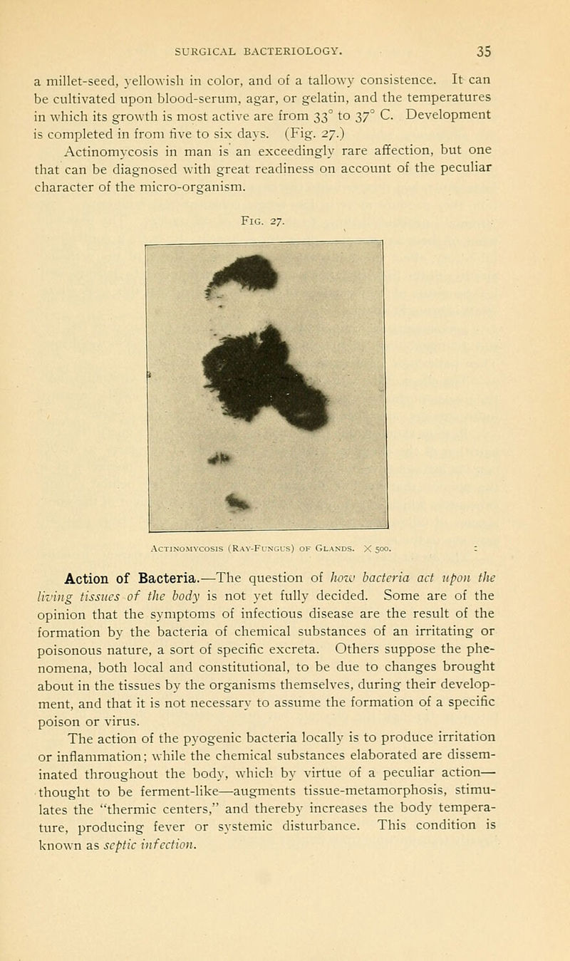 a millet-seed, yellowish in color, and of a tallowy consistence. It can be cultivated upon blood-serum, agar, or gelatin, and the temperatures in which its growth is most active are from 33° to 37° C. Development is completed in from five to six days. (Fig. 27.) Actinomycosis in man is an exceedingly rare affection, but one that can be diagnosed with great readiness on account of the peculiar character of the micro-orsanism. Fig. 27. Actinomycosis (Ray-Fungus) of Glands. X 500. : Action of Bacteria.—The question of Iwzv bacteria act upon the liz'ing tissues of the body is not yet fully decided. Some are of the opinion that the symptoms of infectious disease are the result of the formation by the bacteria of chemical substances of an irritating or poisonous nature, a sort of specific excreta. Others suppose the phe- nomena, both local and constitutional, to be due to changes brought about in the tissues by the organisms themselves, during their develop- ment, and that it is not necessary to assume the formation of a specific poison or virus. The action of the pyogenic bacteria locally is to produce irritation or inflammation; while the chemical substances elaborated are dissem- inated throughout the body, which by virtue of a peculiar action— thought to be ferment-like—augments tissue-metamorphosis, stimu- lates the thermic centers, and thereby increases the body tempera- ture, producing fever or systemic disturbance. This condition is known as septic infection.