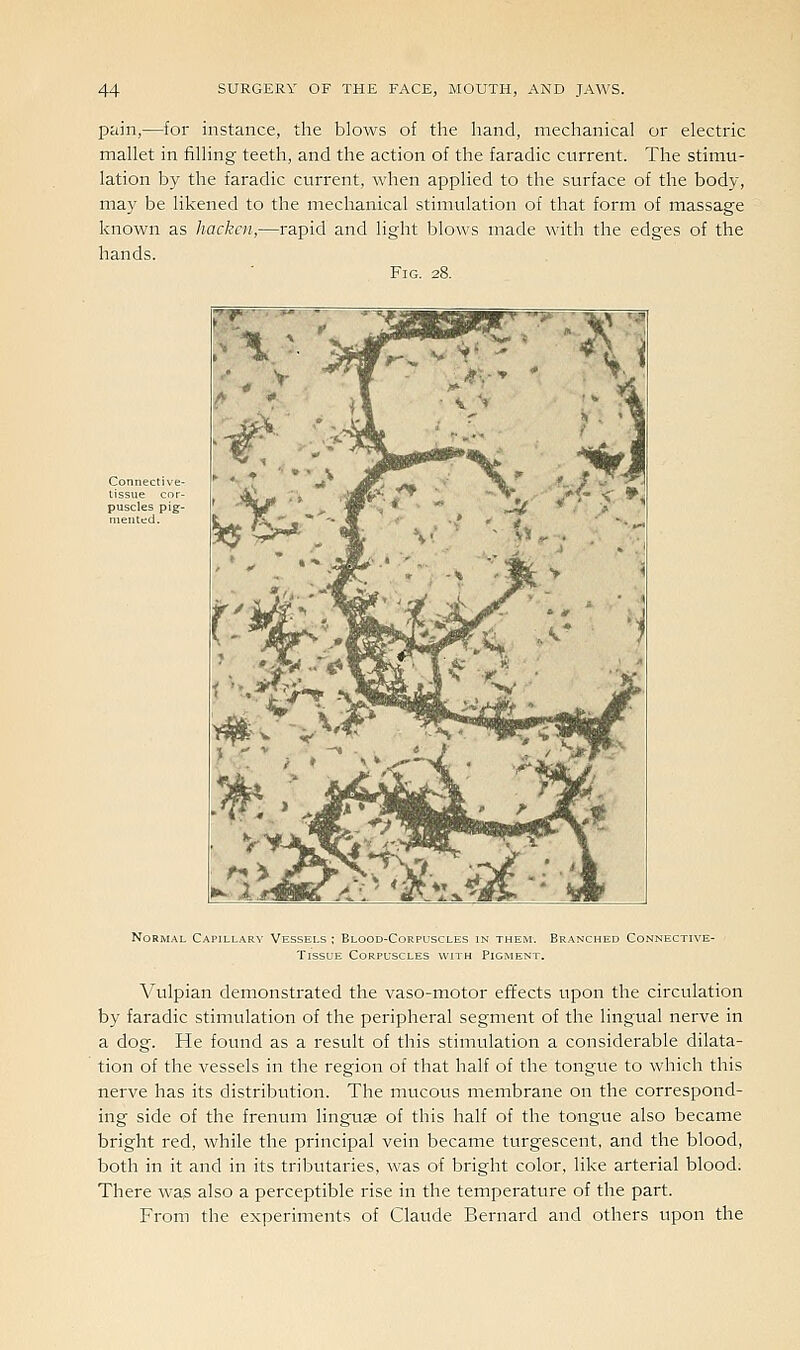 pain,—for instance, the blows of the hand, mechanical or electric mallet in filling teeth, and the action of the faradic current. The stimu- lation by the faradic current, when applied to the surface of the body, may be likened to the mechanical stimulation of that form of massage known as hacken,—rapid and light blows made with the edges of the hands. Fig. 28. Normal Capillary Vessels : Blood-Corpuscles in them. Branched Connective- Tissue Corpuscles with Pigment. Vulpian demonstrated the vaso-motor effects upon the circulation by faradic stimulation of the peripheral segment of the lingual nerve in a dog. He found as a result of this stimulation a considerable dilata- tion of the vessels in the region of that half of the tongue to which this nerve has its distribution. The mucous membrane on the correspond- ing side of the frenum linguae of this half of the tongue also became bright red, while the principal vein became turgescent, and the blood, both in it and in its tributaries, was of bright color, like arterial blood. There was also a perceptible rise in the temperature of the part. From the experiments of Claude Bernard and others upon the