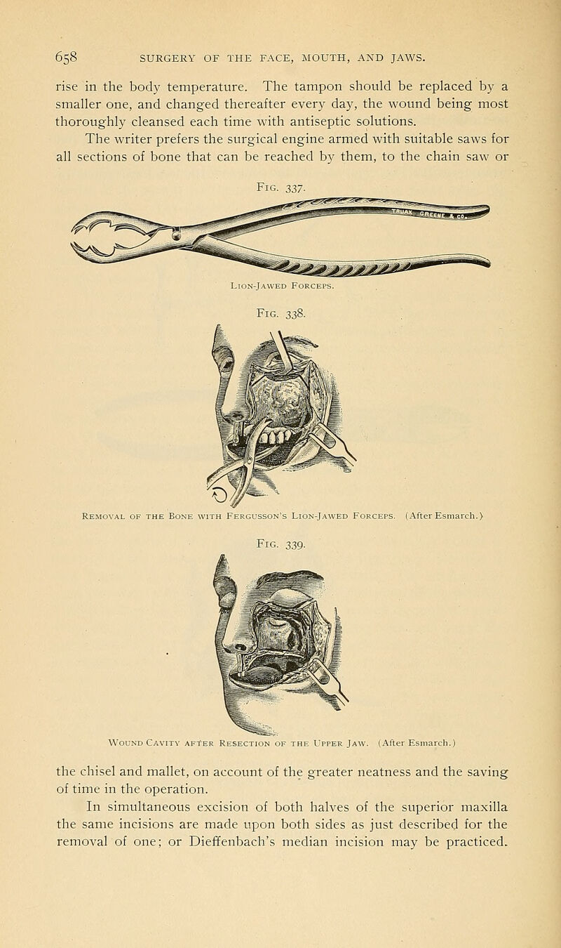 rise in the body temperature. The tampon should be replaced by a smaller one, and changed thereafter every day, the wound being most thoroughly cleansed each tirrie with antiseptic solutions. The writer prefers the surgical engine armed with suitable saws for all sections of bone that can be reached by them, to the chain saw or Fig. 337. Removal of the Bone with Fergusson's Lion-Jawed Forceps. (After Esmarch.) Fig. 339. Wound Cavity after Resection oi- the L pper Jaw. (After Esmarch.) the chisel and mallet, on account of the greater neatness and the saving of time in the operation. In simultaneous excision of both halves of the superior maxilla the same incisions are made upon both sides as just described for the removal of one; or Diefifenbach's median incision may be practiced.