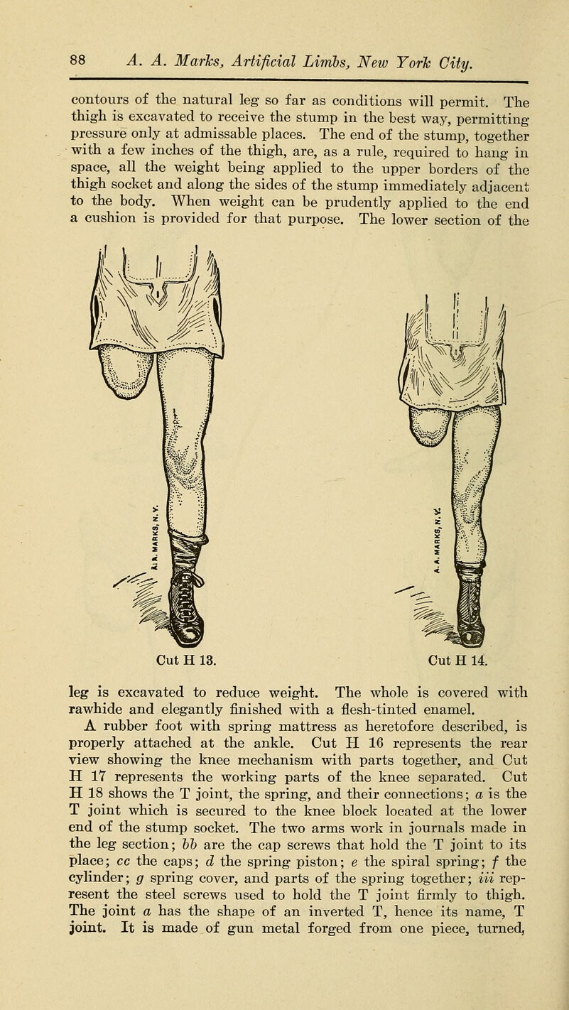 contours of the natural leg so far as conditions will permit. The thigh is excavated to receive the stump in the best way, permitting pressure only at admissable places. The end of the stump, together ■ with a few inches of the thigh, are, as a rule, required to hang in space, all the weight being applied to the upper borders of the thigh socket and along the sides of the stump immediately adjacent to the body. When weight can be prudently applied to the end a cushion is provided for that purpose. The lower section of the Cut H 13. Cut H 14. leg is excavated to reduce weight. The whole is covered with rawhide and elegantly finished with a flesh-tinted enamel. A rubber foot with spring mattress as heretofore described, is properly attached at the ankle. Cut H 16 represents the rear view showing the knee mechanism with parts together, and Cut H 17 represents the working parts of the knee separated. Cut H 18 shows the T joint, the spring, and their connections; a is the T joint which is secured to the knee block located at the lower end of the stump socket. The two arms work in journals made in the leg section; hh are the cap screws that hold the T joint to its place; cc the caps; d the spring piston; e the spiral spring; f the cylinder; g spring cover, and parts of the spring together; Hi rep- resent the steel screws used to hold the T joint firmly to thigh. The joint a has the shape of an inverted T, hence its name, T joint. It is made of gun metal forged from one piece, turned,