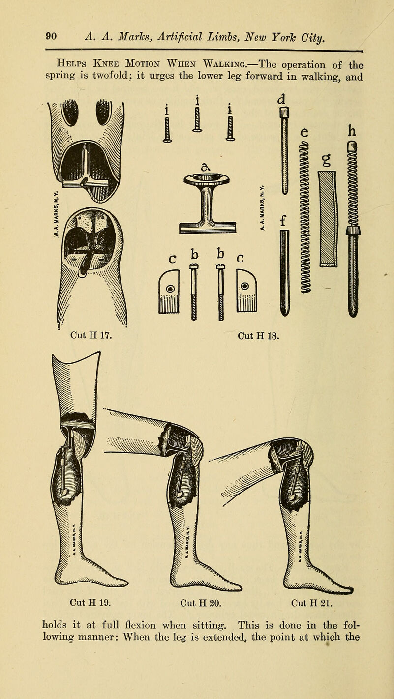 Helps Knee Motion When Walking.—The operation of the spring is twofold; it urges the lower leg forward in walking, and Cut H 19. Cut H 20. Cut H 21. holds it at full flexion when sitting. This is done in the fol- lowing manner: When the leg is extended, the point at which the