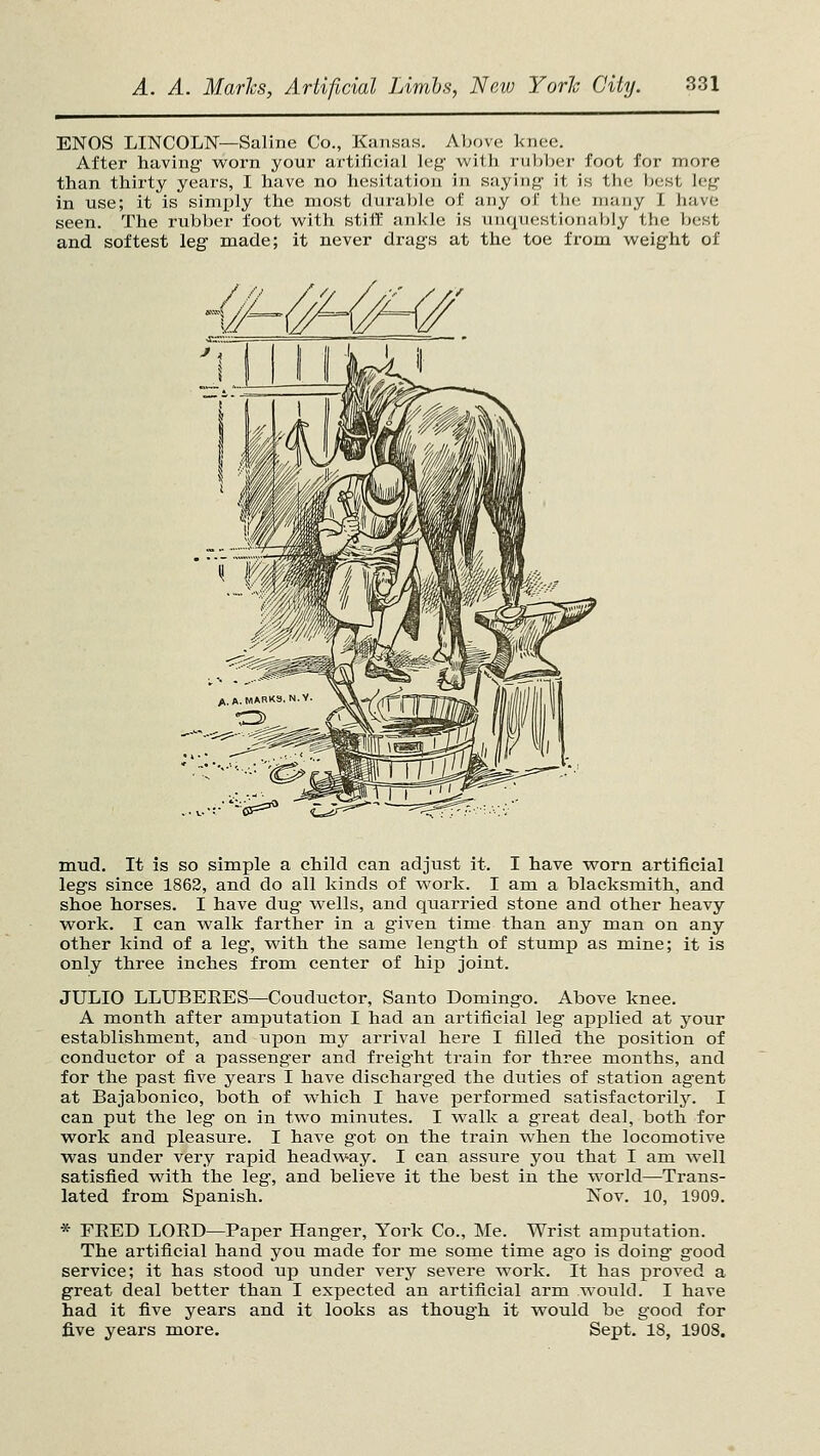 ENOS LINCOLN—Saline Co., Kansas. Above Imec. After having- worn your artificial leg- with rubber foot for more than thirty years, I have no hesitation in saying- it is the best leg in use; it is simply the most durable of any of the many I have seen. The rubber foot with stiff ankle is unquestionably the best and softest leg made; it never drags at the toe from weight of -^=^ mud. It is so simple a child can adjust it. I have worn artificial legs since 1862, and do all kinds of work. I am a blacksmith, and shoe horses. I have dug- wells, and quarried stone and other heavy work. I can walk farther in a given time than any man on any other kind of a leg, with the same length of stump as mine; it is only three inches from center of hip joint. JULIO LLUBERES—Conductor, Santo Domingo. Above knee. A month after amputation I had an artificial leg apijlied at your establishment, and upon my arrival here I filled the position of conductor of a passenger and freight train for three months, and for the past five years I have discharged the duties of station agent at Bajabonico, both of which I have performed satisfactorily. I can put the leg on in two minutes. I walk a great deal, both for work and pleasure. I have got on the train when the locomotive was under very rapid headway. I can assure you that I am well satisfied with the leg, and believe it the best in the world—Trans- lated from Spanish. Nov. 10, 1909. * FEED LOED—Paper Hanger, York Co., Me. Wrist amputation. The artificial hand you made for me some time ago is doing- good service; it has stood up under very severe work. It has proved a great deal better than I expected an artificial arm would. I have had it five years and it looks as though it would be good for fi.ve years raore. Sept. 18, 1908.