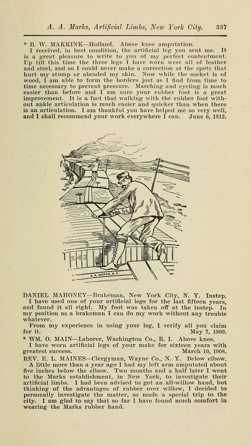 * B. W. MAKKINK—Holland. Above knee amputation. I received, in best condition, the artificial Icfc you sent me. It is a great pleasure to write to you of my perfect contentment. Up till this time the three legs I have worn were all of leather and steel, and so I could never make a correction at the spots that hurt my stump or abraded my skin. Now while the socket is of wood, I am able to form the borders just as I find from time to time necessary to prevent pressure. Marching and cycling is much easier than before and I am sure your rubber foot is a great improvement. It is a fact that walking with the rubber foot with- out ankle articulation is much easier and quicker than when there is an articulation. I am thankful you have helped me so very well, and I shall recommend your work everywhere I can. June 6, 1912. DANIEL MAHONEY—Brakeman, New York City, N. Y, Instep. I have used one of your artificial legs for the last fifteen years, and found it all right. My foot was taken off at the instep. In my position as a brakeman I can do my work without any trouble whatever. From my experience in using your leg, I verify all you claim for it. May 7, 1909. * WM. O. MAIN—Laborer, Washington Co., E. I. Above knee. I have worn artificial legs of your make for sixteen years w^ith greatest success. March 10, 1908. REV. E. L. MAINES—Clergyman, Wayne Co., N. Y. Below elbow. A little more than a year ago I had my left arm amputated about five inches below the elbow. Two months and a half later I went to the Marks establishment, in New York, to investigate their artificial limbs. I had been advised to get an all-willow hand, but thinking of the advantages of rubber over willow, I decided to personally investigate the matter, so made a special trip to the city. I am glad to say that so far I have found much comfort in wearing the Marks rubber hand.