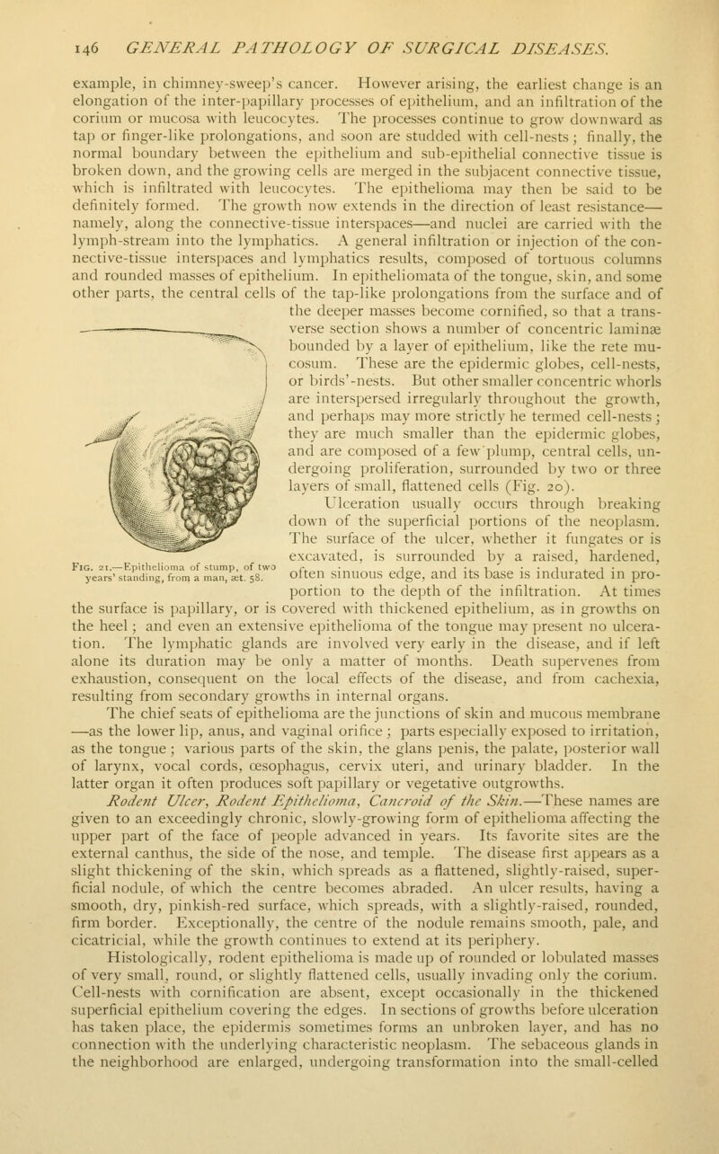 example, in chimney-sweep's cancer. However arising, the earh'est change is an elongation of the inter-])apillary processes of epithelium, and an infiltration of the corium or mucosa with leucocytes. The processes continue to grow downward as tap or finger-like prolongations, and soon are studded with cell-nests; finally, the normal boundary between the epithelium and sub-epithelial connective tissue is broken down, and the growing cells are merged in the subjacent connective tissue, which is infiltrated with leucocytes. The epithelioma may then be said to be definitely formed. The growth now extends in the direction of least resistance— namely, along the connective-tissue interspaces—and nuclei are carried with the lymph-stream into the lymphatics. A general infiltration or injection of the con- nective-tissue interspaces and lymphatics results, comjiosed of tortuous columns and rounded masses of epithelium. In epitheliomata of the tongue, skin, and some other parts, the central cells of the tap-like prolongations from the surface and of the deeper masses become cornified, so that a trans- verse section shows a number of concentric laminae bounded by a layer of epithelium, like the rete mu- cosum. These are the epidermic globes, cell-nests, or birds'-nests. But other smaller concentric whorls are interspersed irregularly throughout the growth, and perhaps may more strictly he termed cell-nests ; they are much smaller than the epidermic globes, and are composed of a few plump, central cells, un- dergoing proliferation, surrounded by two or three layers of small, flattened cells (Fig. 20). Ulceration usually occurs through breaking down of the superficial portions of the neoplasm. The surface of the ulcer, whether it fungates or is excavated, is surrounded by a raised, hardened, often sinuous edge, and its base is indurated in pro- portion to the depth of the infiltration. At times the surface is papillary, or is covered with thickened epithelium, as in growths on the heel; and even an extensive epithelioma of the tongue may present no ulcera- tion. The lymphatic glands are involved very early in the disease, and if left alone its duration may be only a matter of months. Death supervenes from exhaustion, consequent on the local effects of the disease, and from cachexia, resulting from secondary growths in internal organs. The chief seats of epithelioma are the junctions of skin and mucous membrane —as the lower lip, anus, and vaginal orifice ; parts especially exposed to irritation, as the tongue ; various parts of the skin, the glans penis, the palate, posterior wall of larynx, vocal cords, oesophagus, cervix uteri, and urinary bladder. In the latter organ it often produces soft papillary or vegetative outgrowths. Rodent Ulcer, Rodent Epithelioma, Cancroid of the Skin.—These names are given to an exceedingly chronic, slowly-growing form of epithelioma affecting the upper part of the face of people advanced in years. Its favorite sites are the external canthus, the side of the nose, and temple. The disease first appears as a slight thickening of the skin, which spreads as a flattened, slightly-raised, super- ficial nodule, of which the centre becomes abraded. An ulcer results, having a smooth, dry, pinkish-red surface, which spreads, with a slightly-raised, rounded, firm border. Exceptionally, the centre of the nodule remains smooth, pale, and cicatricial, while the growth continues to extend at its periphery. Histologically, rodent epithelioma is made up of rounded or lobulated masses of very small, round, or slightly flattened cells, usually invading only the corium. Cell-nests with cornification are absent, except occasionally in the thickened superficial epithelium covering the edges. In sections of growths before ulceration has taken place, the epidermis sometimes forms an unbroken layer, and has no connection with the underlying characteristic neoplasm. The sebaceous glands in the neighborhood are enlarged, undergoing transformation into the small-celled Fig. 21.—Epithelioma of stump, of two years' standing, from a man, jet. 58.