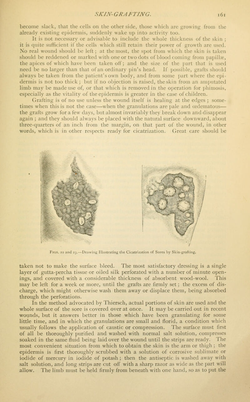 become slack, that the cells on the other side, those which are growing from the already existing epidermis, suddenly wake up into activity too. It is not necessary or advisable to include the whole thickness of the skin ; it is quite sufficient if the cells which still retain their power of growth are used. No real wound should be left; at the most, the spot from which the skin is taken should be reddened or marked with one or two dots of blood coming from papillae, the apices of which have been taken off; and the size of the i)art that is used need be no larger than that of an ordinary pin's head. If possil)le, grafts should always be taken from the ])aticnt's own body, and from some part where the epi- dermis is not too thick; but if no objection is raised, the skin from an amputated limb may be made use of, or that which is removed in the operation for phimosis, especially as the vitality of thee])idermis is greater in the case of children. Grafting is of no use unless the wound itself is healing at the edges ; some- times when this is not the case—when the granulations are pale and uidematous— the grafts grow for a few days, but almost invariably they break down and disappear again ; and they should always be placed with the natural surface downward, about three-cjuarters of an inch from the margin, on that part of the wound, in other words, which is in other respects ready for cicatrization. Great care should be Figs. 22 and 23.—Drawing Illustrating the Cicatrization of Sores by Skin-grafting. taken not to make the surface bleed. The most satisfactory dressing is a single layer of gutta-percha tissue or oiled silk perforated with a number of minute open- ings, and covered with a considerable thickness of absorbent wood-wool. This may be left for a week or more, until the grafts are firmly set; the excess of dis- charge, which might otherwise wash them away or displace them, being absorbed through the perforations. In the method advocated by Thiersch, actual portions of skin are used and the whole surface of the sore is covered over at once. It may be carried out in recent wounds, but it answers better in those which have been granulating for some little time, and in which the granulations are small and florid, a condition which usually follows the application of caustic or compression. The surface must first of all be thoroughly purified and washed with normal salt solution, compresses soaked in the same fluid being laid over the wound until the strii)s are ready. The most convenient situation from which to obtain the skin is the arm or thigh ; the epidermis is first thoroughly scrubbed with a solution of corrosive sublimate or iodide of mercury in iodide of pota-sh; then the antiseptic is washed away with salt solution, and long strips are cut off with a sharp razor as wide as the part will allow. The limb must be held firmly from beneath with one hand, so as to put the