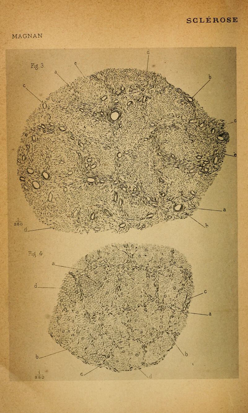 SCLEROSE MAGNAN 260 ^lô 4-' ^::^'-^oy^:^^^vf-^^^ : ^ .;>>^v:•v-:V;:/^^<■^v 1 2SÔ