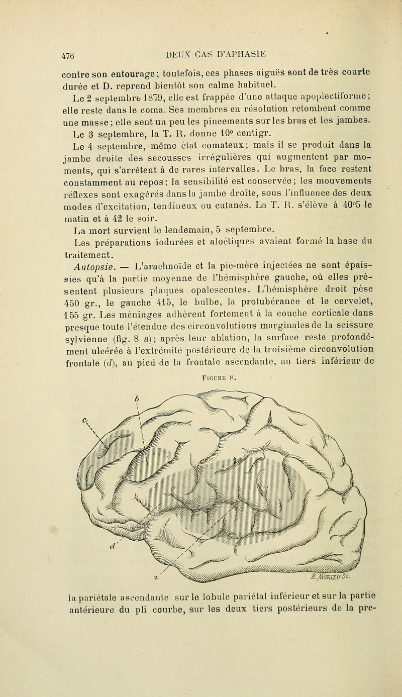 contre son entourage; toutefois, ces phases aiguës sont de très courte durée et D. reprend bientôt son calme habituel. Le 2 septembre 18';9, elle est frappée d'une attaque apoplectiforme; elle reste dans le coma. Ses membres en résolution retombent comme une masse ; elle sent un peu les pincements sur les bras et les jambes. Le 3 septembre, la T. R. donne 10° cenligr. Le 4 septembre, même état comateux; mais il se produit dans la jambe di'oile des secousses irrégulières qui augmentent par mo- ments, qui s'arrêtent à de rares intervalles. Le bras, la face restent constamment au repos; la sensibilité est conservée; les mouvements réflexes sont exagérés dans la jambe droite, sous l'influence des deux modes d'excitation, tendineux ou cutanés. La T. R. s'élève à 40°5 le matin et à 42 le soir. La mort survient le lendemain, 5 septembre. Les préparations iodurées et aloétiques avaient formé la base du traitement. Autopsie. — L'arachnoïde et la pie-mère injectées ne sont épais- sies qu'à la partie moyenne de l'hémisphère gauche, où elles pré- sentent plusieurs plaques opalescentes. L'hémisphère droit pèse 450 gr., le gauche 415, le bulbe, la protubérance et le cervelet, 155 gr. Les méninges adhèi-ent fortement à la couche corticale dans presque toute l'étendue des circonvolutions marginales de la scissure sylvienne (fig. 8 a) ; après leur ablation, la surface reste profondé- ment ulcérée à l'extrémité postérieure de la troisième circonvolution frontale (d), au pied de la frontale ascendante, au tiers inférieur de Figure e. la pariétale ascendante sur le lobule pariétal inférieur et sur la partie antérieure du pli courbe, sur les deux tiers postérieurs de la pre-