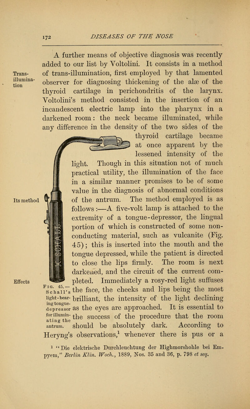 Trans- illumiIla- tion Its method Effects A further means of objective diagnosis was recently added to our list by Voltolini. It consists in a method of trans-illumination, first employed by that lamented observer for diagnosing thickening of the alee of the thyroid cartilage in perichondritis of the larynx. Voltolini's method consisted in the insertion of an incandescent electric lamp into the pharynx in a darkened room: the neck became illuminated, while any difference in the density of the two sides of the thyroid cartilage became at once apparent by the lessened intensity of the light. Though in this situation not of much practical utility, the illumination of the face in a similar manner promises to be of some value in the diagnosis of abnormal conditions of the antrum. The method employed is as follows :—A five-volt lamp is attached to the extremity of a tongue-depressor, the lingual portion of which is constructed of some non- conducting material, such as vulcanite (Fig. 45); this is inserted into the mouth and the tongue depressed, while the patient is directed to close the lips firmly. The room is next darkened, and the circuit of the current com- pleted. Immediately a rosy-red light suffuses ^sc'haii~s the face, the cheeks and lips being the most light-bear- brilliant, the intensity of the light declining depressor as the cycs are approached. It is essential to foriiiumin- ^^ succcss of the proccdurc that the room ating the ^ a t antrum, should be absolutcly dark. According to Heryng's observations,^ whenever there is pus or a 1 Die elektrische Durchleuchtung der Highmorshohle bei Em- pyem, Berlin Klin. Woch., 1889, Nos. 35 and 36, p. 798 et seq.