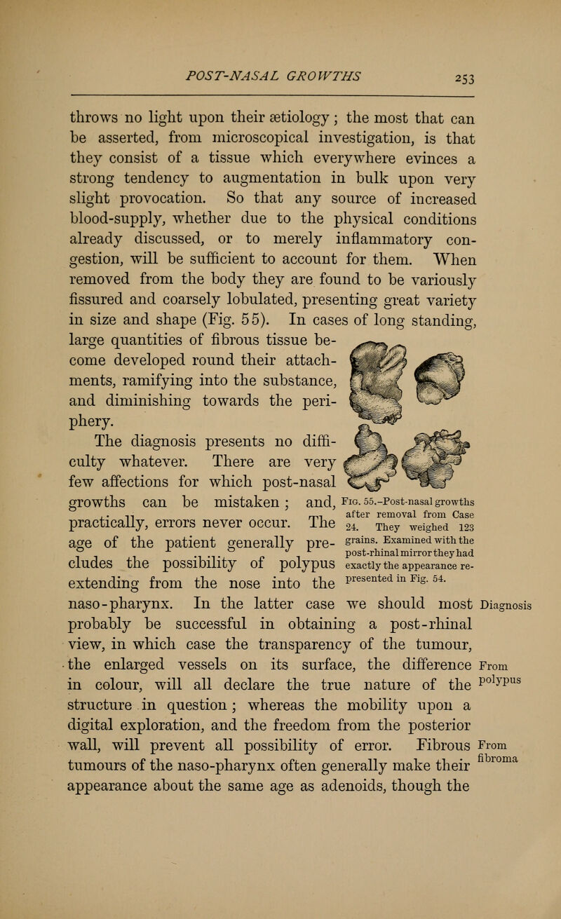 throws no ligtit upon their aetiology; the most that can be asserted, from microscopical investigation, is that they consist of a tissue which everywhere evinces a strong tendency to augmentation in bulk upon very slight provocation. So that any source of increased blood-supply, whether due to the physical conditions already discussed, or to merely inflammatory con- gestion, will be sufficient to account for them. When removed from the body they are found to be variously fissured and coarsely lobulated, presenting great variety in size and shape (Fig. 55). In cases of long standing, large quantities of fibrous tissue be- come developed round their attach- ments, ramifying into the substance, and diminishing towards the peri- phery. The diagnosis presents no diffi- culty whatever. There are very few affections for which post-nasal growths can be mistaken; and, Fio.ss.-Post-nasaigrowths . . TT rrn after removal from Case practically, errors never occur. The 24. They weighed 123 age of the patient sjenerally pre- s^^^^'- Examined with the 5^ .,.,. p 1 post-rhinal mirror they had eludes the possibility of polypus exactlythe appearance re- extending from the nose into the P^^^^^ted in Fig. 54. naso-pharynx. In the latter case we should most Diagnosis probably be successful in obtaining a post-rhinal view, in which case the transparency of the tumour, • the enlarged vessels on its surface, the difference From in colour, will all declare the true nature of the p^^^p^^ structure . in question; whereas the mobility upon a digital exploration, and the freedom from the posterior waU, will prevent all possibility of error. Fibrous From tumours of the naso-pharynx often generally make their ^°°^^ appearance about the same age as adenoids, though the