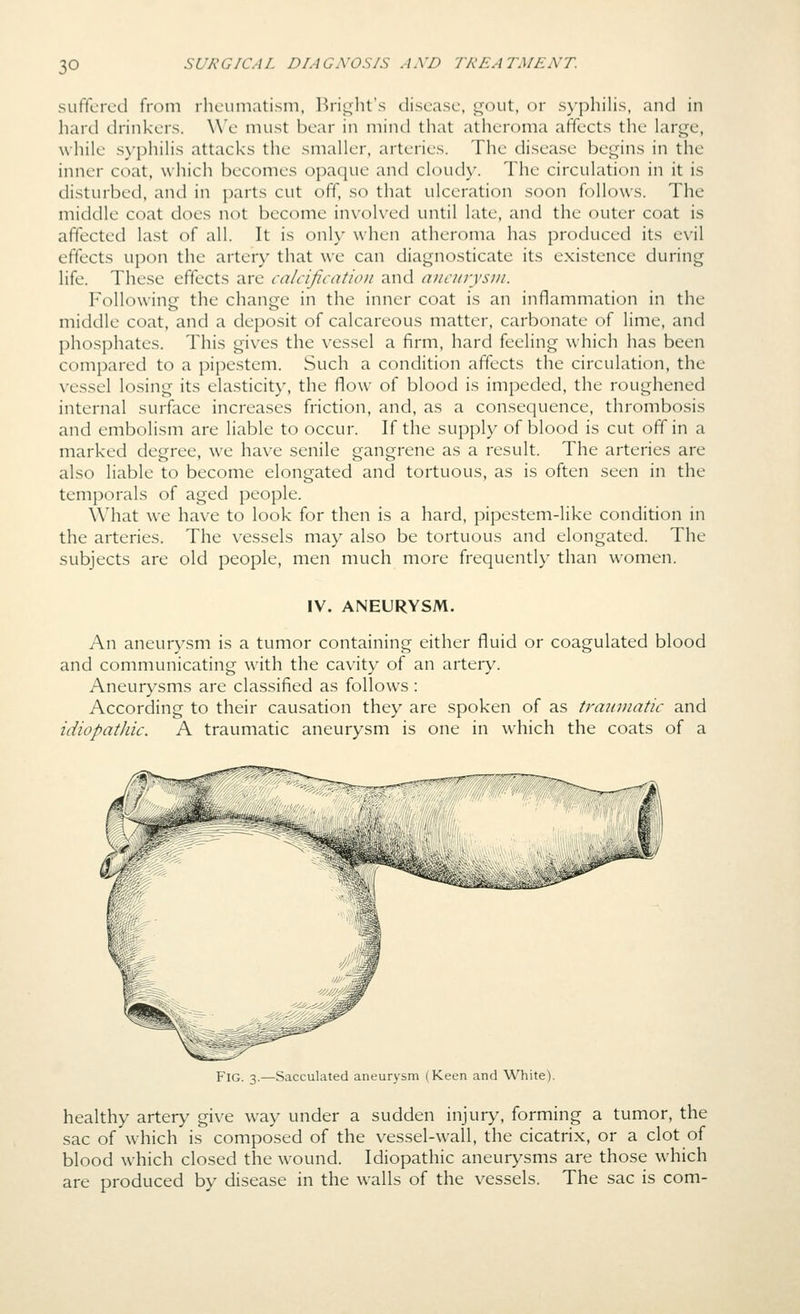 suffered from rheuniatisni, l^right's disease. L^out, or syphilis, and in hard drinkers. We must bear in mind that atheroma affects the large, while s}'philis attacks the smaller, arteries. The disease begins in the inner coat, which becomes opaque and cloudy. The circulation in it is disturbed, and in parts cut off, so that ulceration soon follows. The middle coat does not become involved until late, and the outer coat is affected last of all. It is only when atheroma has produced its evil effects upon the artery that we can diagnosticate its existence during life. These effects are calcification and aneurysm. Following the change in the inner coat is an inflammation in the middle coat, and a deposit of calcareous matter, carbonate of lime, and phosphates. This gives the vessel a firm, hard feeling which has been compared to a pipestem. Such a condition affects the circulation, the vessel losing its elasticity, the flow of blood is impeded, the roughened internal surface increases friction, and, as a consequence, thrombosis and embolism are liable to occur. If the supply of blood is cut off in a marked degree, we have senile gangrene as a result. The arteries are also liable to become elongated and tortuous, as is often seen in the temporals of aged people. What we have to look for then is a hard, pipestem-like condition in the arteries. The vessels may also be tortuous and elongated. The subjects are old people, men much more frequently than women. IV. ANEURYSM. An aneurysm is a tumor containing either fluid or coagulated blood and communicating with the cavity of an artery. Aneurysms are classified as follows : According to their causation they are spoken of as trainnatic and idiopathic. A traumatic aneurysm is one in which the coats of a Fig. 3.—Sacculated aneurysm (Keen and White). healthy artery give way under a sudden injury, forming a tumor, the sac of which is composed of the vessel-wall, the cicatrix, or a clot of blood which closed the wound. Idiopathic aneurysms are those which are produced by disease in the walls of the vessels. The sac is com-