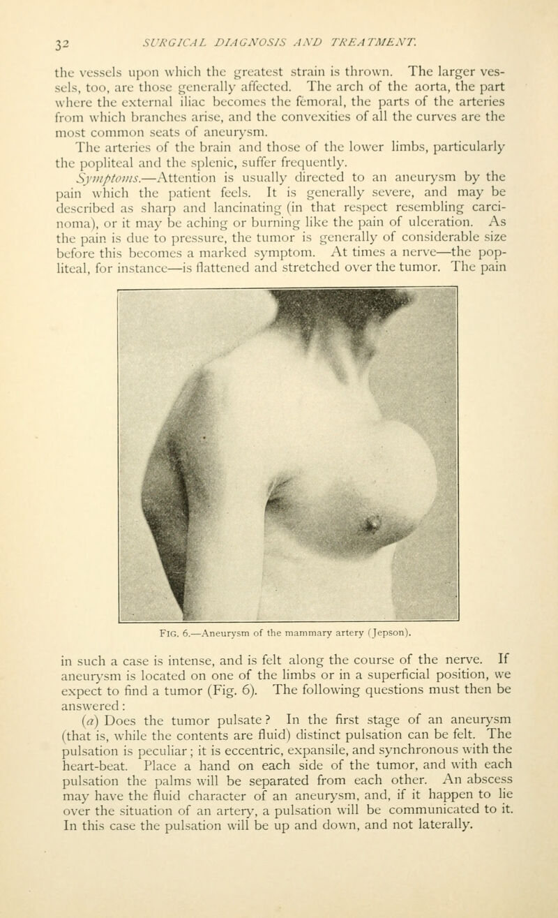 the vessels upon w hich tlic greatest strain is thrown. The larger ves- sels, too, are those generally affected. The arch of the aorta, the part where the external iliac becomes the femoral, the parts of the arteries from which branches arise, and the convexities of all the curves are the most common seats of aneurj-sm. The arteries of the brain and those of the lower limbs, particularly the popliteal and the splenic, suffer frequently. Symptoms.—Attention is usually directed to an aneur>'sm by the pain which the patient feels. It is generally severe, and may be described as sharp and lancinating (in that respect resembling carci- noma), or it may be aching or burning like the pain of ulceration. As the pain is due to pressure, the tumor is generally of considerable size before this becomes a marked symptom. At times a nerve—the pop- liteal, for instance—is flattened and stretched over the tumor. The pain Fig. 6.—Aneurysm of the mammary artery (Jepson). in such a case is intense, and is felt along the course of the nerve. If aneur>'sm is located on one of the limbs or in a superficial position, we expect to find a tumor (Fig. 6). The following questions must then be answered: (a) Does the tumor pulsate ? In the first stage of an aneurysm (that is, while the contents are fluid) distinct pulsation can be felt. The pulsation is peculiar; it is eccentric, expansile, and synchronous with the heart-beat. Place a hand on each side of the tumor, and with each pulsation the palms will be separated from each other. An abscess may have the fluid character of an aneurysm, and, if it happen to lie over the situation of an artery, a pulsation will be communicated to it. In this case the pulsation will be up and down, and not laterally.