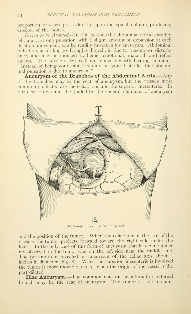 SCA'G/C.U. jn.iGXOS/S AND TKEAIMEAV. proportion of cases press clirectl)' upon the spinal column, producing erosion of the bones. lirrors to l)c Avoided.— In thin persons the abdominal aorta is readily felt, and a strong pulsation, with a slight amount of expansion at each diastolic movement, can be readily mistaken for aneurysm. Abdominal pulsation, according to Douglas Powell, is due to vasomotor disturb- ance, and may be induced by hemic, emotional, malarial, and reflex causes. The advice of Sir William Jenner is worth bearing in mind:  Instead of being your first, it should be your last idea that abdom- inal pulsation is due to aneurysm. Aneurysm of the Branches of the Abdominal Aorta.—An>- of the branches may be the seat of aneurysm, but the vessels most commonly affected are the celiac axis and the superior mesenteric. In our decision we must be guided by the general character of aneurysm Fig. 8.—Aneurysm of the celiac axis. and the position of the tumor. When the celiac axis is the seat of the disease the tumor projects forward toward the right side under the liver. In the only case of this form of aneurysm that has come under my observation the tumor was on the left side near the middle line. The post-mortem revealed an aneurysm of the celiac axis about 4 inches in diameter (Fig. 8). When the superior mesenteric is involved the tumor is more movable, except when the origin of the vessel is the part dilated. Iliac Aneurysm.—The common iliac or the internal or external branch may be the seat of aneurysm. The tumor is soft, circum-