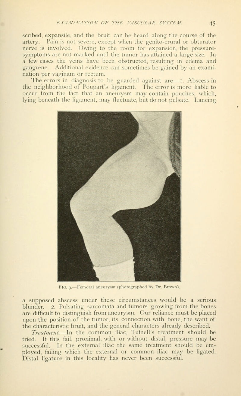 scribed, expansile, and the bruit can be heard along the course of the artery. Pain is not severe, except when the genito-crural or obturator nerve is involved. Owing to the room for expansion, the pressure- symptoms are not marked until the tumor has attained a large size. In a few cases the veins have been obstructed, resulting in edema and gangrene. Additional evidence can sometimes be gained by an exami- nation per vaginam or rectum. The errors in diagnosis to be guarded against are—i. Abscess in the neighborhood of Poupart's ligament. The error is more liable to occur from the fact that an aneurysm may contain pouches, which, lying beneath the ligament, may fluctuate, but do not pulsate. Lancing bv Dr. Rrown). a supposed abscess under these circumstances would be a serious blunder. 2. Pulsating sarcomata and tumors growing from the bones are difficult to distinguish from aneurysm. Our reliance must be placed upon the position of the tumor, its connection with bone, the want of the characteristic bruit, and the general characters already described. Treatmoit.—In the common iliac. Tufnell's treatment should be tried. If this fail, proximal, with or without distal, pressure may be successful. In the external iliac the same treatment should be em- ployed, failing which the external or common iliac may be ligated. Distal ligature in this locality has never been successful.