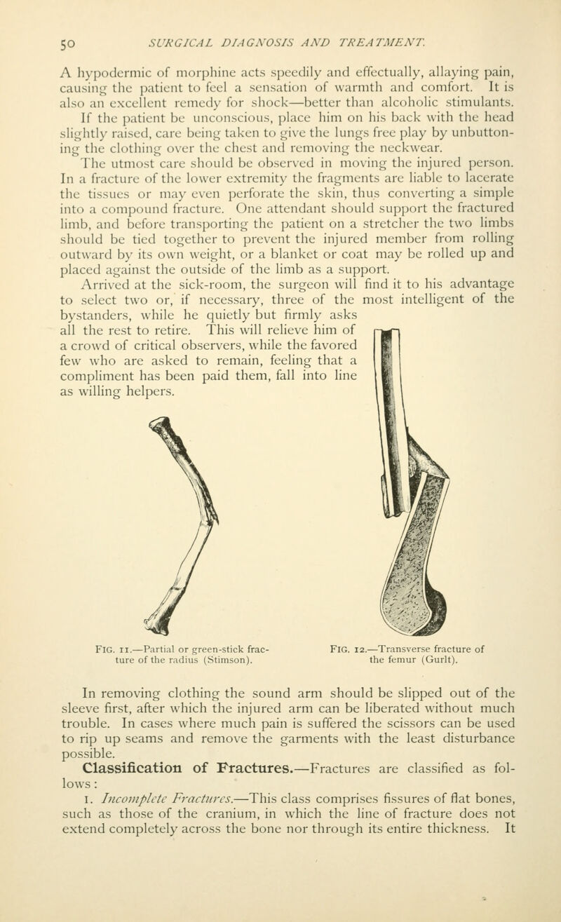 A hypodermic of morphine acts speedily and effectually, allaying pain, causing the patient to feel a sensation of warmth and comfort. It is also an excellent remedy for shock—better than alcoholic stimulants. If the patient be unconscious, place him on his back with the head slightly raised, care being taken to give the lungs free play by unbutton- ing the clothing over the chest and removing the neckwear. The utmost care should be observed in moving the injured person. In a fracture of the lower extremity the fragments are liable to lacerate the tissues or may even perforate the skin, thus converting a simple into a compound fracture. One attendant should support the fractured limb, and before transporting the patient on a stretcher the two limbs should be tied together to prevent the injured member from rolling outward by its own weight, or a blanket or coat may be rolled up and placed against the outside of the limb as a support. Arrived at the sick-room, the surgeon will find it to his advantage to select two or, if necessary, three of the most intelligent of the bystanders, while he quietly but firmly asks all the rest to retire. This will relieve him of a crowd of critical observers, while the favored few who are asked to remain, feeling that a compliment has been paid them, fall into line as willing helpers. Fig. II.—Partial or green-stick frac- ture of the radius (Stimson). Fig. 12.—Transverse fracture of the femur (Gurlt). In removing clothing the sound arm should be slipped out of the sleev^e first, after which the injured arm can be liberated without much trouble. In cases where much pain is suffered the scissors can be used to rip up seams and remove the garments with the least disturbance possible. Classification of Fractures.—Fractures are classified as fol- lows : I. Incoinplctc Fractures.—This class comprises fissures of flat bones, such as those of the cranium, in which the line of fracture does not extend completely across the bone nor through its entire thickness. It