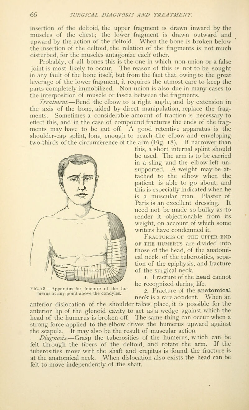 insertion of the deltoid, the upper fragment is drawn inward by the muscles of the chest; the lower fragment is drawn outward and upward by the action of the deltoid. When the bone is broken below the insertion of the deltoid, the relation of the fragments is not much disturbed, for the muscles antagonize each other. Probably, of all bones this is the one in which non-union or a false joint is most likely to occur. The reason of this is not to be sought in any fault of the bone itself, but from the fact that, owing to the great leverage of the lower fragment, it requires the utmost care to keep the parts completely immobilized. Non-union is also due in many cases to the interposition of muscle or fascia between the fragments. Treatment.—Bend the elbow to a right angle, and by extension in the axis of the bone, aided by direct manipulation, replace the frag- ments. Sometimes a considerable amount of traction is necessary to effect this, and in the case of compound fractures the ends of the frag- ments may have to be cut off A good retentive apparatus is the shoulder-cap splint, long enough to reach the elbow and enveloping two-thirds of the circumference of the arm (Fig. i8). If narrower than this, a short internal splint should be used. The arm is to be carried in a sling and the elbow left un- supported. A weight may be at- tached to the elbow when the patient is able to go about, and this is especially indicated when he is a muscular man. Plaster of Paris is an excellent dressing. It need not be made so bulky as to render it objectionable from its weight, on account of which some writers have condemned it. Fractures of the upper exd OF THE humerus are divided into those of the head, of the anatomi- cal neck, of the tuberosities, sepa- tion of the epiphysis, and fracture of the surgical neck. 1. Fracture of the head cannot be recognized during life. 2. Fracture of the anatomical neck is a rare accident. When an Fig. i8.—Apparatus for fracture of the hu- merus at any point above the condyles. anterior dislocation of the shoulder takes place, it is possible for the anterior lip of the glenoid cavity to act as a wedge against which the head of the humerus is broken off The same thing can occur when a strong force applied to the elbow drives the humerus upward against the scapula. It may also be the result of muscular action. Diagnosis.—Grasp the tuberosities of the humerus, which can be felt through the fibers of the deltoid, and rotate the arm. If the tuberosities move with the shaft and crepitus is found, the fracture is at the anatomical neck. When dislocation also exists the head can be felt to move independently of the shaft.