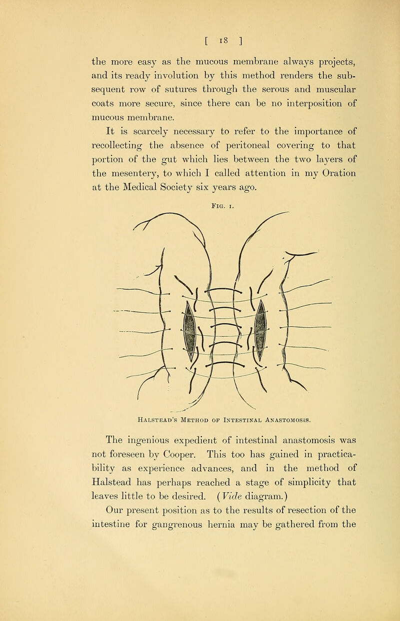 the more easy as the mucous membrane always projects, and its ready involution by this method renders the sub- sequent row of sutures through the serous and muscular coats more secure, since there can be no interposition of mucous membrane. It is scarcely necessary to refer to the importance of recollecting the absence of peritoneal covering to that portion of the gut which lies between the two layers of the mesentery, to which I called attention in my Oration at the Medical Society six years ago. Halstead's Method op Intestinal Anastomosis. The ingenious expedient of intestinal anastomosis was not foreseen by Cooper. This too has gained in practica- bility as experience advances, and in the method of Halstead has perhaps reached a stage of simplicity that leaves little to be desired. (Vide diagram.) Our present position as to the results of resection of the intestine for gangrenous hernia may be gathered from the