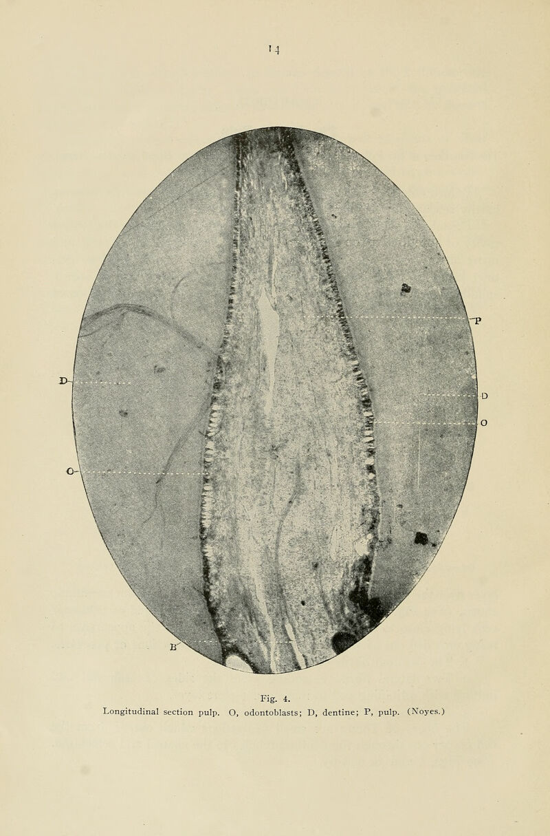 '4 Fig. 4. Longitudinal section pulp. O, odontoblasts; D, dentine; P, pulp. (Noyes.)