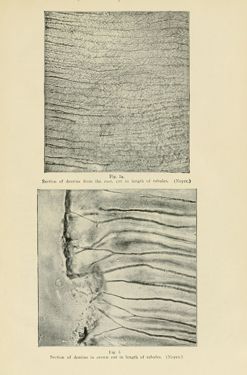 r .l-!g. 5a. Section of dentine from the root, cut in length of tubyles. (Noyes.) i'ig. .1 Section of dentine in crown cut in length of tubules. (Xoyes.)