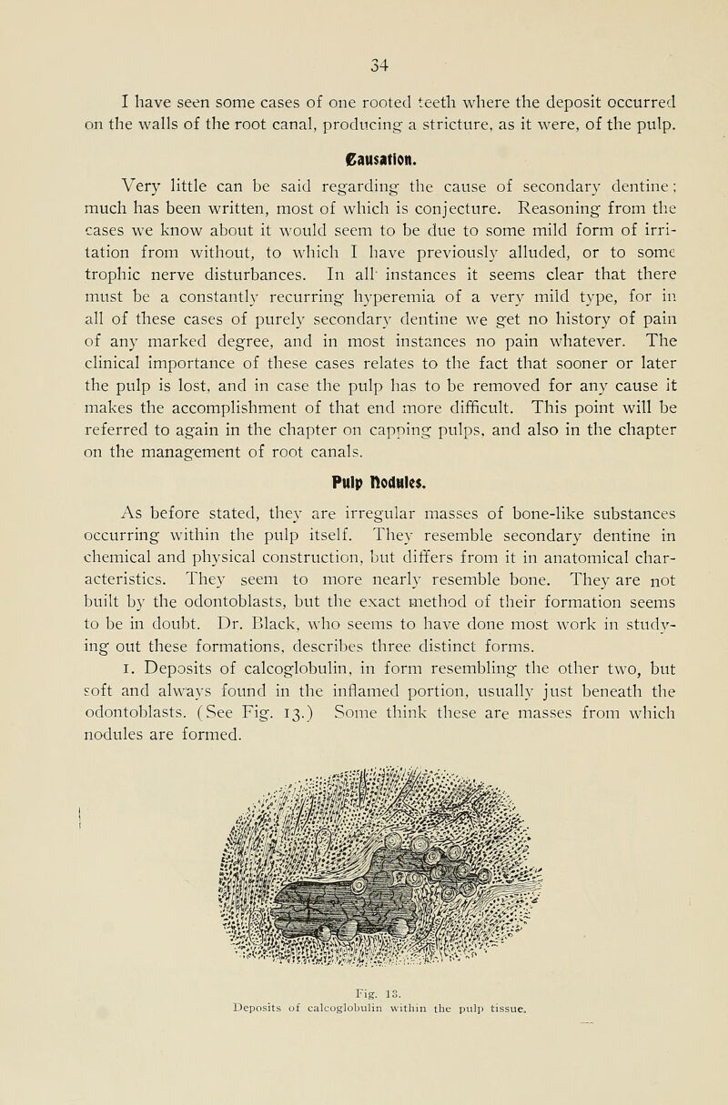 I have seen some cases of one rooted teeth where the deposit occurred on the walls of the root canal, producing- a stricture, as it were, of the pulp. Causation. Very little can be said regarding- the cause of secondary dentine; much has been written, most of which is conjecture. Reasoning from the cases we know about it would seem to be due to some mild form of irri- tation from without, to which I have previously alluded, or to some trophic nerve disturbances. In all instances it seems clear that there must be a constantly recurring hyperemia of a very mild type, for in all of these cases of purely secondary dentine we get no history of pain of any marked degree, and in most instances no pain whatever. The clinical importance of these cases relates to the fact that sooner or later the pulp is lost, and in case the pulp has to be removed for any cause it makes the accomplishment of that end more difficult. This point will be referred to again in the chapter on capping pulps, and also in the chapter on the management of root canals. Pulp nodules. As before stated, they are irregular masses of bone-like substances occurring within the pulp itself. They resemble secondary dentine in chemical and physical construction, but differs from it in anatomical char- acteristics. They seem to more nearly resemble bone. They are not built by the odontoblasts, but the exact method of their formation seems to be in doubt. Dr. Black, who seems to have done most work in study- ing out these formations, describes three distinct forms. I. Deposits of calcoglobulin, in form resembling the other two, but soft and always found in the inflamed portion, usually just beneath the odontoblasts. (See Fig. 13.) Some think these are masses from which nodules are formed. - ^'v^m.: Fig. 13. Deposits of calcoglobulin within the pulp tissue.