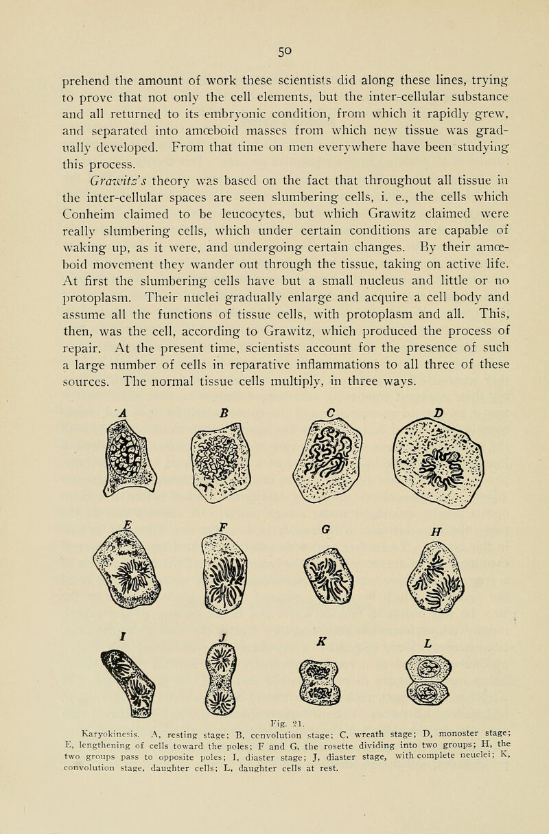 prehend the amount of work these scientists did along these lines, trying to prove that not only the cell elements, but the inter-cellular substance and all returned to its embryonic condition, from which it rapidly grew, and separated into amoeboid masses from which new tissue was grad- ually developed. From that time on men everywhere have been studying this process. Grazvit::'s theory was based on the fact that throughout all tissue in the inter-cellular spaces are seen slumbering cells, i. e., the cells which Conheim claimed to be leucocytes, but which Grawitz claimed were really slumbering cells, which under certain conditions are capable of waking up, as it were, and undergoing certain changes. By their amoe- boid movem.ent they wander out through the tissue, taking on active life. At first the slumbering cells have but a small nucleus and little or no protoplasm. Their nuclei gradually enlarge and acquire a cell body and assume all the functions of tissue cells, with protoplasm and all. This, then, was the cell, according to Grawitz, which produced the process of repair. At the present time, scientists account for the presence of such a large number of cells in reparative inflammations to all three of these sources. The normal tissue cells multiply, in three ways. Fig. 21. Karyokinesis. A, resting stage; B, convolution stage; C, wreath stage; D, monoster stage; E, lengthening of cells toward the poles; F and G, the rosette dividing into two groups; H, the two groups pass to opposite poles; I, diaster stage; J, diaster stage, with complete neuclei; K, convolution stage, daughter cells; L, daughter cells at rest.
