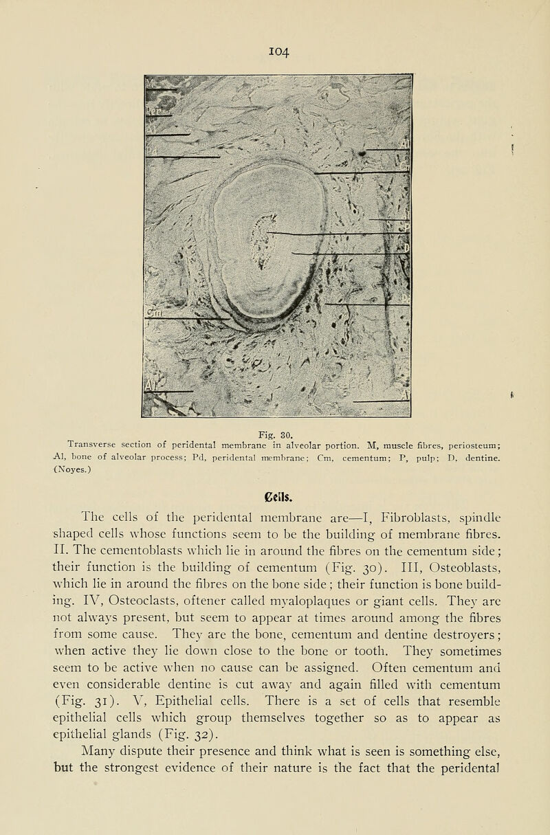 M ^ » .,1^- p Fig. 30. Transverse section of peridental membrane in alveolar portion. M, muscle fibres, periosteum; Al, bone of alveolar process; Pd, peridental membrane; Cm, cementum; P, pulp; D, dentine. (Noyes.) Cells. The cells of the peridental membrane are—I, Fibroblasts, spindle shaped cells whose functions seem to be the building of membrane fibres. II. The cementoblasts which lie in around the fibres on the cementum side; their function is the building- of cementum (Fig. 30). Ill, Osteoblasts, which lie in around the fibres on the bone side; their function is bone build- ing. IV, Osteoclasts, oftener called myaloplaques or giant cells. They are not always present, but seem to appear at times around among the fibres from some cause. They are the bone, cementum and dentine destroyers; when active they lie down close to the bone or tooth. They sometimes seem to be active when no cause can be assigned. Often cementum and even considerable dentine is cut away and again filled with cementum (Fig. 31). V, Epithelial cells. There is a set of cells that resemble epithelial cells which group themselves together so as to appear as epithelial glands (Fig. 32). Many dispute their presence and think what is seen is something else, but the strongest evidence of their nature is the fact that the peridental