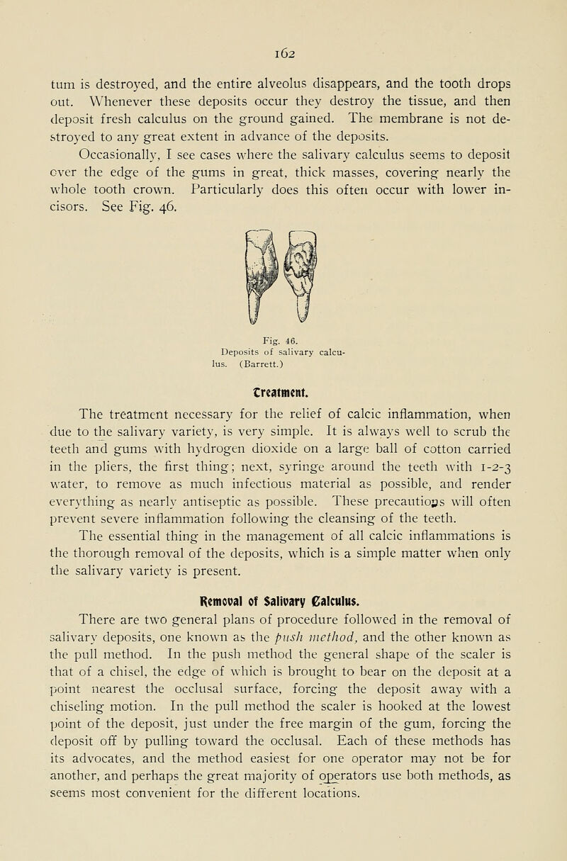 turn is destroyed, and the entire alveolus disappears, and the tooth drops out. Whenever these deposits occur they destroy the tissue, and then deposit fresh calculus on the ground gained. The membrane is not de- stroyed to any great extent in advance of the deposits. Occasionally, I see cases where the salivary calculus seems to deposit over the edge of the gums in great, thick masses, covering nearly the whole tooth crown. Particularly does this often occur with lower in- cisors. See Fig. 46. Fig. 46. Deposits of salivary calcu- lus. (Barrett.) treatment The treatment necessary for the relief of calcic inflammation, when due to the salivary variety, is very simple. It is always well to scrub the teeth and gums with hydrogen dioxide on a large ball of cotton carried in the pliers, the first thing; next, syringe around the teeth with 1-2-3 water, to remove as much infectious material as possible, and render everything as nearly antiseptic as possible. These precautiojjs will often prevent severe inflammation following the cleansing of the teeth. The essential thing in the management of all calcic inflammations is the thorough removal of the deposits, which is a simple matter when only the salivary variety is present. Remcval of Salivary Calculus. There are two general plans of procedure followed in the removal of salivary deposits, one known as the push method, and the other known as the pull method. In the push method the general shape of the scaler is that of a chisel, the edge of which is brought to bear on the deposit at a point nearest the occlusal surface, forcing the deposit away with a chiseling motion. In the pull method the scaler is hooked at the lowest point of the deposit, just under the free margin of the gum, forcing the deposit off by pulling toward the occlusal. Each of these methods has its advocates, and the method easiest for one operator may not be for another, and perhaps the great majority of operators use both methods, as seems most convenient for the different locations.