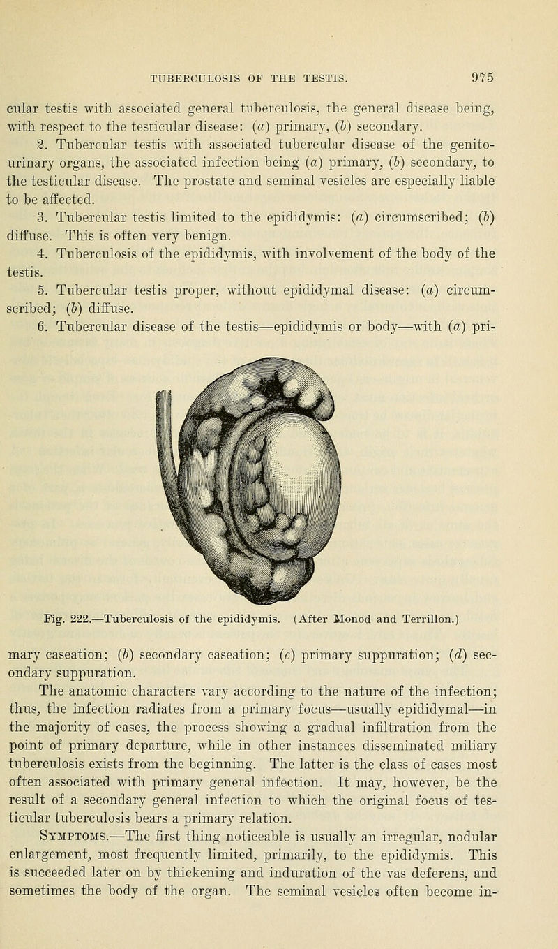 cular testis with associated general tuberculosis, the general disease being, with respect to the testicular disease: (a) primary,.(b) secondary. 2. Tubercular testis with associated tubercular disease of the genito- urinary organs, the associated infection being (a) primary, (b) secondary, to the testiciilar disease. The prostate and seminal vesicles are especially liable to be affected. 3. Tubercular testis limited to the epididymis: (a) circumscribed; (&) diffuse. This is often very benign. 4. Tuberculosis of the epididymis, with involvement of the body of the testis. 5. Tubercular testis proper, without epididymal disease: (a) circum- scribed; (&) diffuse. 6. Tubercular disease of the testis—epididymis or body—with (a) pri- Fig. 222.—Tuberculosis of the epididymis. (After Monod and Terrillon.) mary caseation; (h) secondary caseation; (c) primary suppuration; (d) sec- ondary suppuration. The anatomic characters vary according to the nature of the infection; thus, the infection radiates from a primary focus—usually epididymal—in the majority of cases, the process showing a gradual infiltration from the point of primary departure, while in other instances disseminated miliary tuberculosis exists from the beginning. The latter is the class of cases most often associated with primary general infection. It may, however, be the result of a secondary general infection to which the original focus of tes- ticular tuberculosis bears a primary relation. Symptoms.—The first thing noticeable is usually an irregular, nodular enlargement, most frequently limited, primarily, to the epididymis. This is succeeded later on by thickening and induration of the vas deferens, and sometimes the body of the organ. The seminal vesicles often become in-