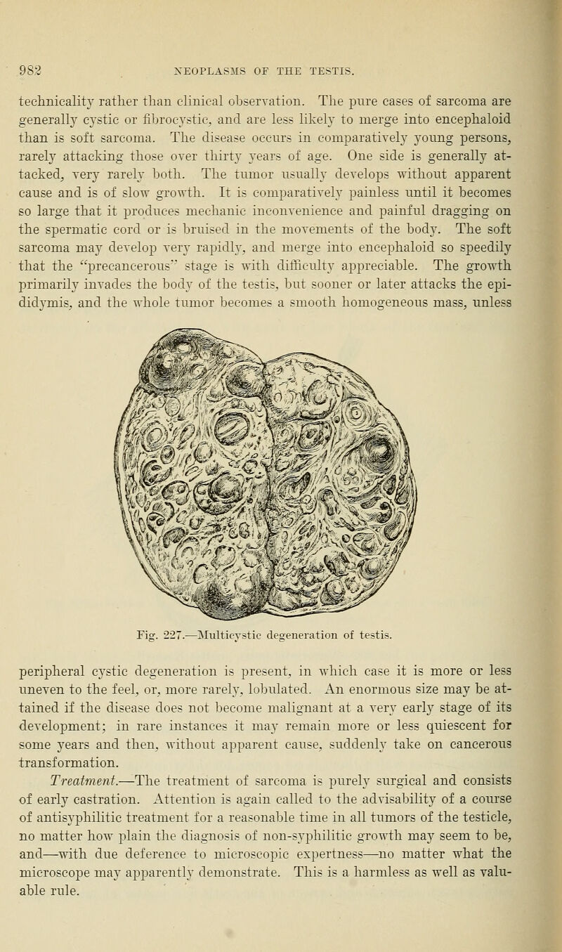 technicality ratlier than clinical observation. The pure cases of sarcoma are generally cystic or fibrocystic, and are less likely to merge into encephaloid than is soft sarcoma. The disease occurs in comparatively young persons, rarely attacking those over thirty years of age. One side is generally at- tacked, very rarely both. The tumor usually develops without apparent cause and is of slow growth. It is comparatively painless until it becomes so large that it produces mechanic inconvenience and painful dragging on the spermatic cord or is bruised in the movements of the body. The soft sarcoma may develop) very rapidly, and merge into encephaloid so speedily that the precancerous' stage is with difficulty appreciable. The growth primarily invades the body of the testis, but sooner or later attacks the epi- didj^mis, and the whole tumor becomes a smooth homogeneous mass, unless Fio^. 227.—MulticYstic deaeneration of testis. peripheral cystic degeneration is present, in which case it is more or less uneven to the feel, or, more rarely, lobulated. An enormous size may be at- tained if the disease does not become malignant at a very early stage of its development; in rare instances it may remain more or less quiescent for some 5^ears and then, without apparent cause, suddenly take on cancerous transformation. Treatment.—The treatment of sarcoma is purely surgical and consists of early castration. Attention is again called to the advisability of a course of antis3'philitic treatment for a reasonable time in all tumors of the testicle, no matter how plain the diagnosis of non-syphilitic growth may seem to be, and—with due deference to microscopic expertness—no matter what the microscope may apparently demonstrate. This is a harmless as well as valu- able rule.