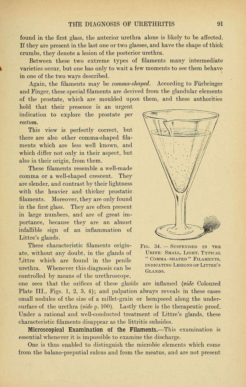 found in the first glass, tlie anterior urethra alone is likely to be affected. If they are present in the last one or two glasses, and have the shape of thick crumbs, they denote a lesion of the posterior urethra. Between these two extreme types of filaments many intermediate varieties occur, but one has only to wait a few moments to see them behave in one of the two ways described. Again, the filaments may be comma-shaped. According to Fiirbringer and Finger, these special filaments are derived from the glandular elements of the prostate, which are moulded upon them, and these authorities hold that their presence is an urgent indication to explore the prostate per rectum. This view is perfectly correct, but there are also other comma-shaped fila- ments which are less well known, and which differ not only in their aspect, but also in their origin, from them. These filaments resemble a well-made comma or a well-shaped crescent. They are slender, and contrast by their lightness with the heavier and thicker prostatic filaments. Moreover, they are only found in the first glass. They are often present in large numbers, and are of great im- portance, because they are an almost infallible sign of an inflammation of Littre's glands. These characteristic filaments origin- FiG. 34, — Suspended in the Urine: Small, Light, Typical  Comma-shaped Filaments, INDICATING Lesions oe Littre's Glands. ate, without any doubt, in the glands of Littre which are found in the penile urethra. Whenever this diagnosis can be controlled by means of the urethroscope, one sees that the orifices of these glands are inflamed {vide Coloured Plate III., Figs. 1, 2, 3, 4); and palpation always reveals in these cases small nodules of the size of a millet-grain or hempseed along the under- surface of the urethra {vide p. 100). Lastly there is the therapeutic proof. Under a rational and well-conducted treatment of Littre's glands, these characteristic filaments disappear as the littritis subsides. Microscopical Examination of the Filaments.—This examination is essential whenever it is impossible to examine the discharge. One is thus enabled to distinguish the microbic elements which come from the balano-preputial sulcus and from the meatus, and are not present