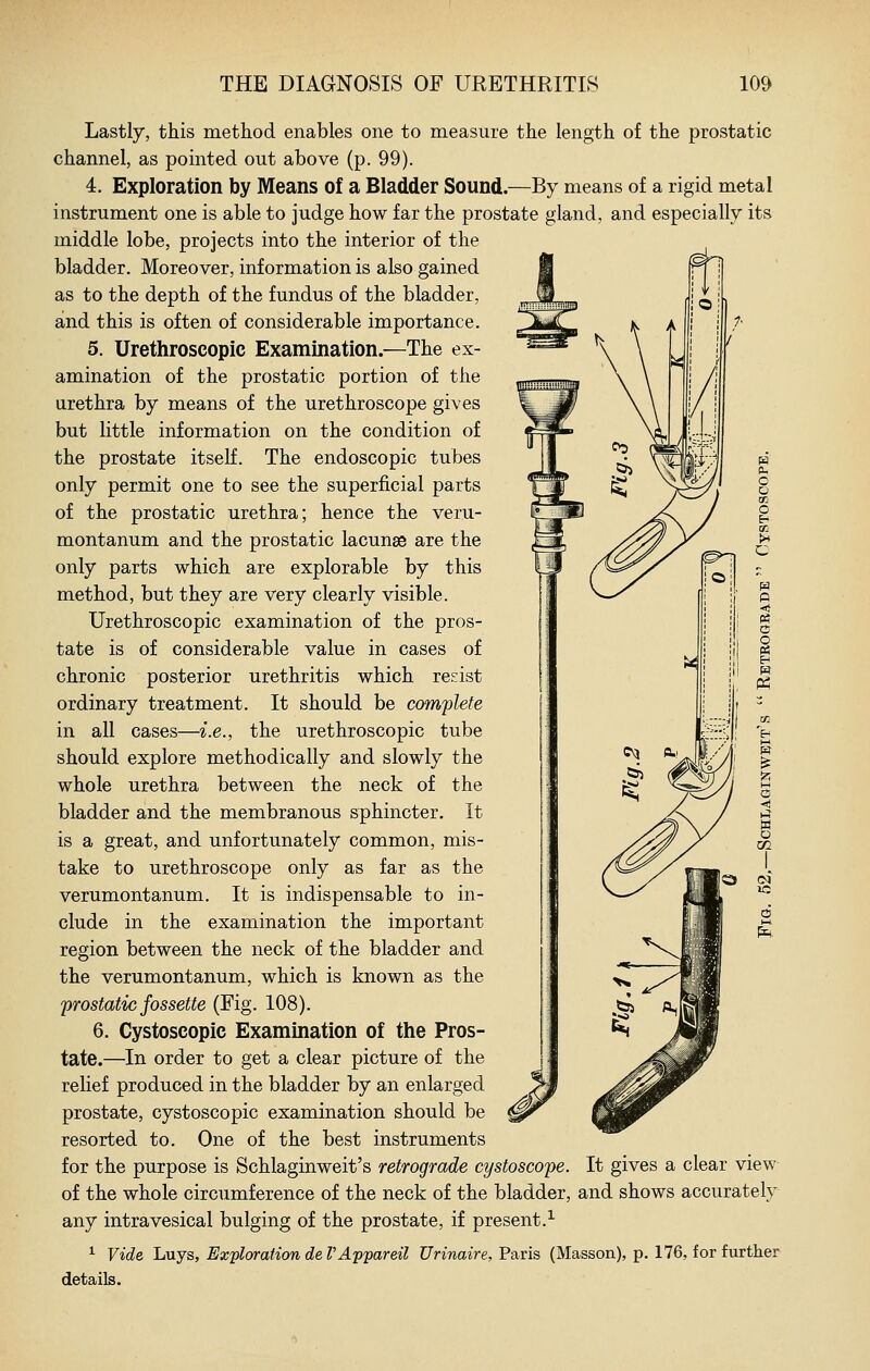 Lastly, this method enables one to measure the length of the prostatic channel, as pointed out above (p. 99). 4. Exploration by Means of a Bladder Sound.—By means of a rigid metal instrument one is able to judge how far the prostate gland, and especially its middle lobe, projects into the interior of the bladder. Moreover, information is also gained as to the depth of the fundus of the bladder, and this is often of considerable importance. 5. Urethroscopic Examination.—The ex- amination of the prostatic portion of the urethra by means of the urethroscope gives but little information on the condition of the prostate itself. The endoscopic tubes only permit one to see the superficial parts of the prostatic urethra; hence the veru- montanum and the prostatic lacunae are the only parts which are explorable by this method, but they are very clearly visible. Urethroscopic examination of the pros- tate is of considerable value in cases of chronic posterior urethritis which resist ordinary treatment. It should be complete in all cases—i.e., the urethroscopic tube should explore methodically and slowly the whole urethra between the neck of the bladder and the membranous sphincter. It is a great, and unfortunately common, mis- take to urethroscope only as far as the verumontanum. It is indispensable to in- clude in the examination the important region between the neck of the bladder and the verumontanum, which is known as the prostatic jossette (Fig. 108). 6. Cystoscopic Examination of the Pros- tate.—In order to get a clear picture of the relief produced in the bladder by an enlarged prostate, cystoscopic examination should be resorted to. One of the best instruments for the purpose is Schlaginweit's retrograde cystoscope. It gives a clear view of the whole circumference of the neck of the bladder, and shows accurately any intravesical bulging of the prostate, if present.^ ^ Vide Luys, Exploration de VAppareil Urinaire, Paris (Masson), p. 176, for further details. pa P <} PS c o P2 tn o
