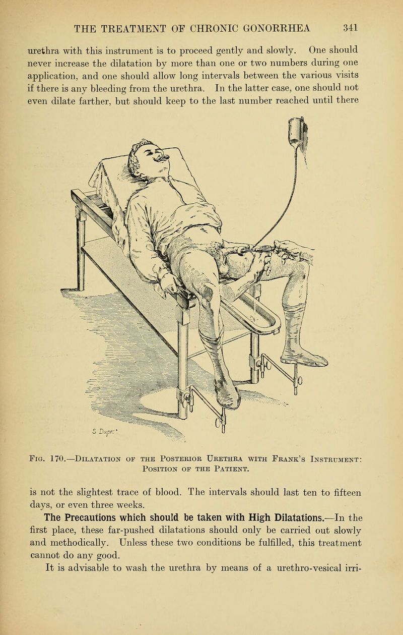 urethra with this instrument is to proceed gently and slowly. One should never increase the dilatation by more than one or two numbers during one application, and one should allow long intervals between the various visits if there is any bleeding from the urethra. In the latter case, one should not even dilate farther, but should keep to the last number reached until there Fig. 170.—Dilatation op the Posterior Urethra with Frank's Instrument: Position op the Patient. is not the shghtest trace of blood. The intervals should last ten to fifteen days, or even three weeks. The Precautions which should be taken with High Dilatations.—In the first place, these far-pushed dilatations should only be carried out slowly and methodically. Unless these two conditions be fulfilled, this treatment cannot do any good. It is advisable to wash the urethra by means of a urethro-vesical irri-