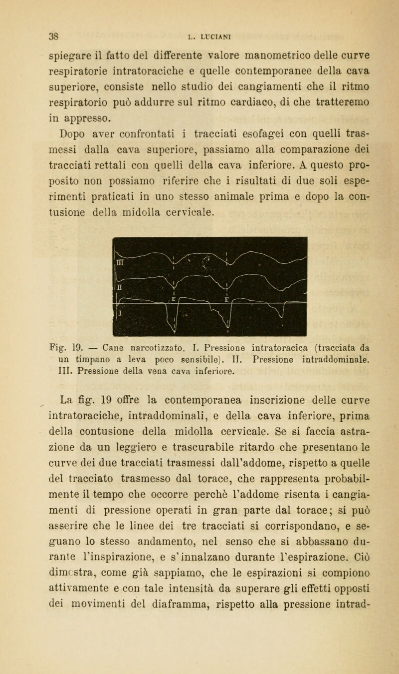 spiegare il fatto del differente valore manometrico delle curve respiratorie intratoraciche e quelle contemporanee della cava superiore, consiste nello studio dei cangiamenti che il ritmo respiratorio può addurre sul ritmo cardiaco, di che tratteremo in appresso. Dopo aver confrontati i tracciati esofagei con quelli tras- messi dalla cava superiore, passiamo alla comparazione dei tracciati rettali con quelli della cava inferiore. A questo pro- posito non possiamo riferire che i risultati di due soli espe- rimenti praticati in uno stesso animale prima e dopo la con- tusione della midolla cervicale. Fig. 19. — Cane narcotizzato. I. Pressione intratoracica (tracciata da un timpano a leva poco sensibile). II. Pressione intraddominale. III. Pressione della vena cava inferiore. La fig. 19 offre la contemporanea inscrizione delle curve intratoraciche, intraddominali, e della cava inferiore, prima della contusione della midolla cervicale. Se si faccia astra- zione da un leggiero e trascurabile ritardo che presentano le curve dei due tracciati trasmessi dall'addome, rispetto a quelle del tracciato trasmesso dal torace, che rappresenta probabil- mente il tempo che occorre perchè l'addome risenta i cangia- menti di pressione operati in gran parte dal torace; si può asserire che le linee dei tre tracciati si corrispondano, e se- guano lo stesso andamento, nel senso che si abbassano du- rante l'inspirazione, e s'innalzano durante l'espirazione. Ciò dimostra, come già sappiamo, che le espirazioni si compiono attivamente e con tale intensità da superare gli effetti opposti dei movimenti del diaframma, rispetto alla pressione intrad-