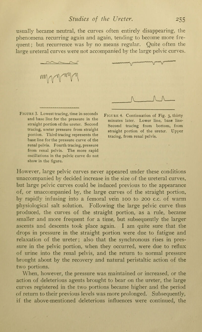 usually became neutral, the curves often entirely disappearing, the phenomena recurring again and again, tending to become more fre- quent ; but recurrence was by no means regular. Quite often the large ureteral curves were not accompanied by the large pelvic curves. fflY^Wl ~M~~*~~~»*Y^™M~'—\r\r^*~~ Figure 4. Continuation of Fig. 3, thirty minutes later. Lower line, base line- Second tracing from bottom, from straight portion of the ureter. Upper tracing, from renal pelvis. Figure 3. Lowest tracing, time in seconds and base line for the pressure in the straight portion of the ureter. Second tracing, ureter pressure from straight portion. Third tracing represents the base line for the pressure curve of the renal pelvis. Fourth tracing, pressure from renal pelvis. The more rapid oscillations in the pelvic curve do not show in the figure. However, large pelvic curves never appeared under these conditions unaccompanied by decided increase in the size of the ureteral curves, but large pelvic curves could be induced previous to the appearance of, or unaccompanied by, the large curves of the straight portion, by rapidly infusing into a femoral vein 100 to 200 c.c. of warm physiological salt solution. Following the large pelvic curve thus produced, the curves of the straight portion, as a rule, became smaller and more frequent for a time, but subsequently the larger ascents and descents took place again. I am quite sure that the drops in pressure in the straight portion were due to fatigue and relaxation of the ureter; also that the synchronous rises in pres- sure in the pelvic portion, when they occurred, were due to reflux of urine into the renal pelvis, and the return to normal pressure brought about by the recovery and natural peristaltic action of the two portions. When, however, the pressure was maintained or increased, or the action of deleterious agents brought to bear on the ureter, the large curve ra\ in the two portions became higher and the period of n-turn to their previous levels was more prolonged. Subsequently, if the above-mentioned deleterious influences were continued, the