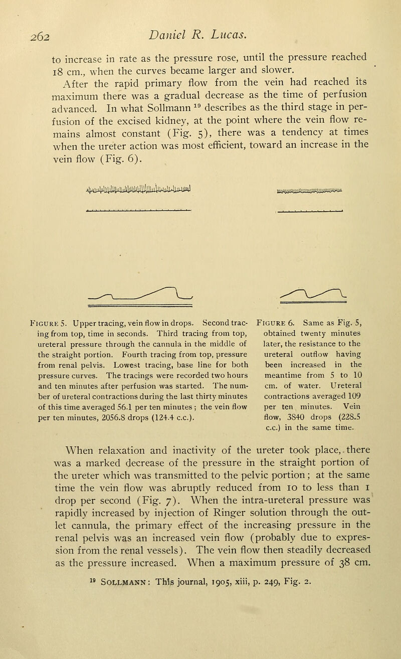 to increase in rate as the pressure rose, until the pressure reached 18 cm., when the curves became larger and slower. After the rapid primary flow from the vein had reached its maximum there was a gradual decrease as the time of perfusion advanced. In what Sollmann 19 describes as the third stage in per- fusion of the excised kidney, at the point where the vein flow re- mains almost constant (Fig. 5), there was a tendency at times when the ureter action was most efficient, toward an increase in the vein flow (Fig. 6). 4^%llW^ 111«111^MJ1UU1)UB111MW1BU1WPWW- Figure 5. Upper tracing, vein flow in drops. Second trac- ing from top, time in seconds. Third tracing from top, ureteral pressure through the cannula in the middle of the straight portion. Fourth tracing from top, pressure from renal pelvis. Lowest tracing, base line for both pressure curves. The tracings were recorded two hours and ten minutes after perfusion was started. The num- ber of ureteral contractions during the last thirty minutes of this time averaged 56.1 per ten minutes ; the vein flow per ten minutes, 2056.8 drops (124.4 c.c). Figure 6. Same as Fig. 5, obtained twenty minutes later, the resistance to the ureteral outflow having been increased in the meantime from 5 to 10 cm. of water. Ureteral contractions averaged 109 per ten minutes. Vein flow, 3840 drops (228.5 c.c.) in the same time. When relaxation and inactivity of the ureter took place, there was a marked decrease of the pressure in the straight portion of the ureter which was transmitted to the pelvic portion; at the same time the vein flow was abruptly reduced from 10 to less than 1 drop per second (Fig. 7). When the intra-ureteral pressure was' rapidly increased by injection of Ringer solution through the out- let cannula, the primary effect of the increasing pressure in the renal pelvis was an increased vein flow (probably due to expres- sion from the renal vessels). The vein flow then steadily decreased as the pressure increased. When a maximum pressure of 38 cm.