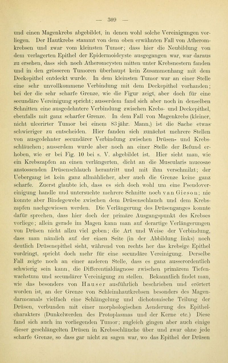 und einen Magenkrebs abgebildet, in denen wohl solche Vereinigungen vor- liegen. Der Hautkrebs stammt von dem oben erwähnten Fall von Atherom- krebsen und zwar vom kleinsten Tumor; dass hier die Neubildung von dem verlagerten Epithel der Epidermoidcyste ausgegangen war, war daraus zu ersehen, dass sich noch Atheromcysten mitten unter Krebsnestern fanden und in den grösseren Tumoren überhaupt kein Zusammenhang mit dem Deckepithel entdeckt wurde. In dem kleinsten Tumor war an einer Stelle eine sehr unvollkommene Verbindung mit dem Deckepithel vorhanden; bei der die sehr scharfe Grenze, wie die Figur zeigt, aber doch für eine secundäre Vereinigung spricht; ausserdem fand sich aber noch in denselben Schnitten eine ausgedehntere Verbindung zwischen Krebs- und Deckepithel, ebenfalls mit ganz scharfer Grenze. In dem Fall von Magenkrebs (kleiner, nicht ulcerirter Tumor bei einem 83 jähr. Mann,) ist die Sache etwas- schwieriger zu entscheiden. Hier fanden sich zunächst mehrere Stellen von ausgedehnter secundärer Verbindung zwischen Drüsen- und Krebs- schläuchen ; ausserdem wurde aber noch an einer Stelle der Befund er- hoben, wie er bei Fig. 10 bei s. V. abgebildet ist. Hier sieht man, wie ein Krebszapfen an einen verlängerten, dicht an die Muscularis mucosae anstossenden Drüsenschlauch herantritt und mit ihm verschmilzt; der Uebergang ist kein ganz allmählicher, aber auch die Grenze keine ganz scharfe. Zuerst glaubte ich, dass es sich doch wohl um eine Pseudover- einigung handle und untersuchte mehi-ere Schnitte noch van Gieson; nie konnte aber Bindegewebe z^udschen dem Drüsenschlauch und dem Krebs- zapfen nachgewiesen werden. Die Verlängerung des Drüsenganges konnte dafür sprechen, dass hier doch der primäre Ausgangspunkt des Krebses vorhege; allein gerade im Magen kann man auf derartige Verlängerungen von Drüsen nicht allzu viel geben; die Art und Weise der Verbindung, dass man nämhch auf der einen Seite (in der Abbildung links) noch deutlich Drüsenepithel sieht, während von rechts her das krebsige Epithel vordringt, spricht doch mehr für eine secundäre Vereinigung. Derselbe Fall zeigte noch an einer anderen Stelle, dass es ganz ausserordentlich schwierig sein kann, die Differentialdiagnose zwischen primärem Tiefen- wachstum und secundärer Vereinigung zu stellen. Bekannthch findet man, wie das besonders von Haus er ausführlich beschrieben und erörtert worden ist, an der Grenze von Schleimhautkrebsen besonders des Magen- darm canals vielfach eine Schlängelung und dichotomische Teilung der Drüsen, verbunden mit einer morphologischen Aenderung des Epithel- charakters (Dunkelwerden des Protoplasmas und der Kerne etc.) Diese fand sich auch im vorliegenden Tumor; zugleich gingen aber auch einige dieser geschlängelten Drüsen in Krebsschläuche über und zwar ohne jede scharfe Grenze, so dass gar nicht zu sagen war, wo das Epithel der Drüsen
