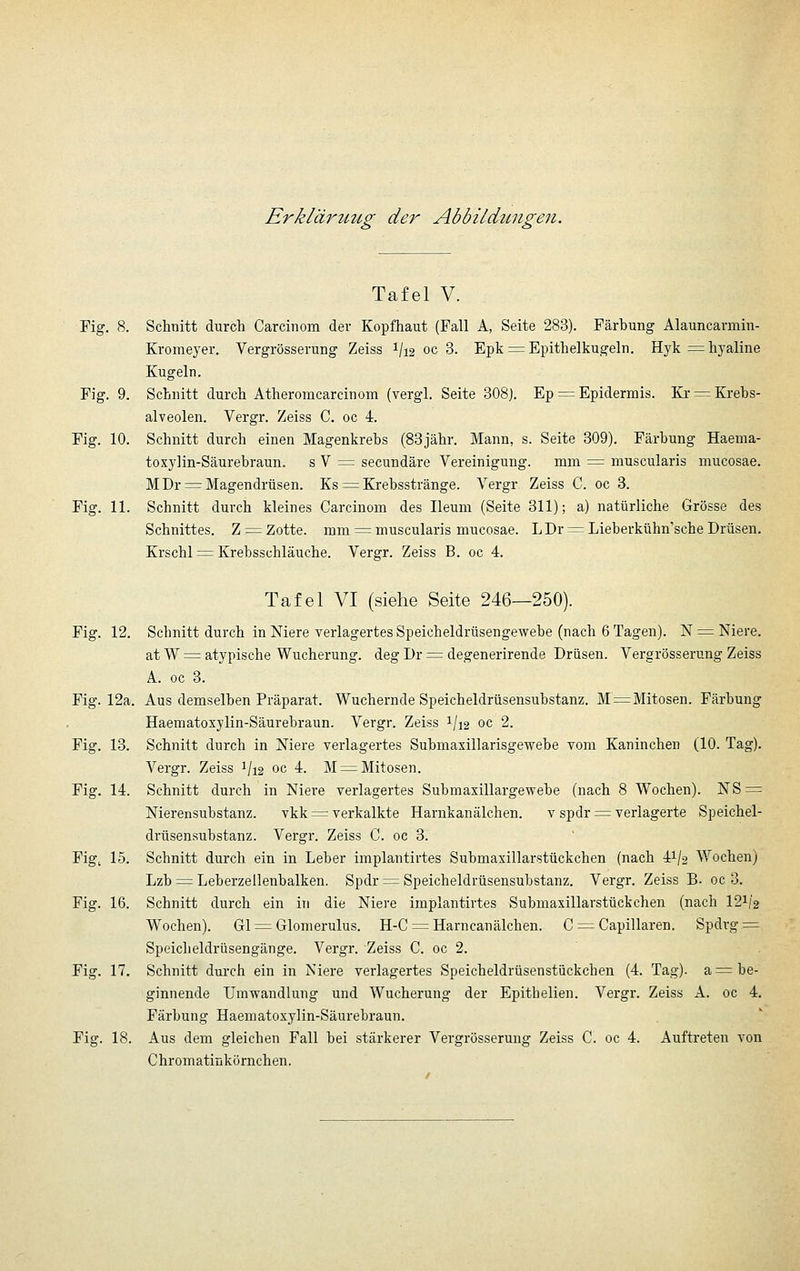 Erkläruttg der Abbildzmgen. Tafel V. Fig. 8. Schnitt durch Carcinom der Kopfhaut (Fall A, Seite 283). Färbung Alauncarmin- Kromeyer. Vergrösserung Zeiss 1/12 oc 3. Epk = Epithelkugeln. Hyk ^ hyaline Kugeln. Fig. 9. Schnitt durch Atheromcarcinom (vergl. Seite 308). Ep = Epidermis. Kr := Krebs- alveolen. Vergr. Zeiss C. oc 4. Fig. 10. Schnitt durch einen Magenkrebs (83jähr. Mann, s. Seite 309). Färbung Haema- toxylin-Säurebraun. s V ^ secundäre Vereinigung. mm =; muscularis mucosae. MDr = Magendrüsen. Ks :^ Krebsstränge. Vergr Zeiss C. oc 3. Fig. 11. Schnitt durch kleines Carcinom des Ileum (Seite 311); a) natürliche Grösse des Schnittes. Z = Zotte, mm = muscularis mucosae. LDr = Lieberkühn'sche Drüsen. Krschl ^ Krebsschläuche. Vergr. Zeiss B. oc 4. Tafel VI (siehe Seite 246—250). Fig. 12. Schnitt durch in Niere verlagertes Speicheldrüsengewebe (nach 6 Tagen). N = Niere. atW^ atypische Wucherung, deg Dr = degenerirende Drüsen. Vergrösserung Zeiss A. oc 3. Fig. 12a. Aus demselben Präparat. Wuchernde Speicheldrüsensubstanz. M = Mitosen. Färbung Haeniatoxylin-Säurebraun. Vergr. Zeiss 1/12 oc 2. Fig. 13. Schnitt durch in Niere verlagertes Submaxillarisgewebe vom Kaninchen (10. Tag). Vergr. Zeiss 1/12 oc 4. M^ Mitosen. Fig. 14. Schnitt durch in Niere verlagertes Submaxillargewebe (nach 8 Wochen). NS:= Nierensubstanz. vkk = verkalkte Harnkanälchen. v spdr =^ verlagerte Speichel- drüsensubstanz. Vergr. Zeiss C. oc 3. Figi 15. Schnitt durch ein in Leber implantirtes Submaxillarstückchen (nach 41/2 Wochen) Lzb = Leberzellenbalken. Spdr = Speicheldrüsensubstanz. Vergr. Zeiss B. oc 3. Fig. 16. Schnitt durch ein in die Niere implantirtes Submaxillarstückchen (nach I21/2 Wochen). Gl = Glomerulus. H-C:=Harncanälchen. C ^^Capillaren. Spdrg = Speicheldrüsengänge. Vergr. Zeiss C. oc 2. Fig. 17. Schnitt durch ein in Niere verlagertes Speicheldrüsenstiickchen (4. Tag), a^ be- ginnende Umwandlung und Wucherung der Epithelien. Vergr. Zeiss A. oc 4. Färbung Haematoxylin-Säurebraun. Fig. 18. Aus dem gleichen Fall bei stärkerer Vergrösserung Zeiss C. oc 4. Auftreten von Chromatiukörnchen.
