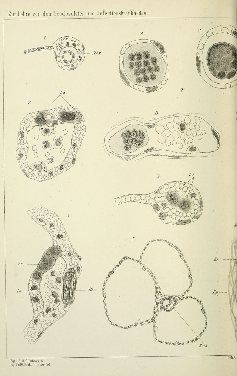 A - RAz. ^g^Sh -^ -^ ^^^ Mz. ,«' Ar — i>.— HgJS.n O.Lubarsch Fig.9u.lO,PaulaOmilherdel.