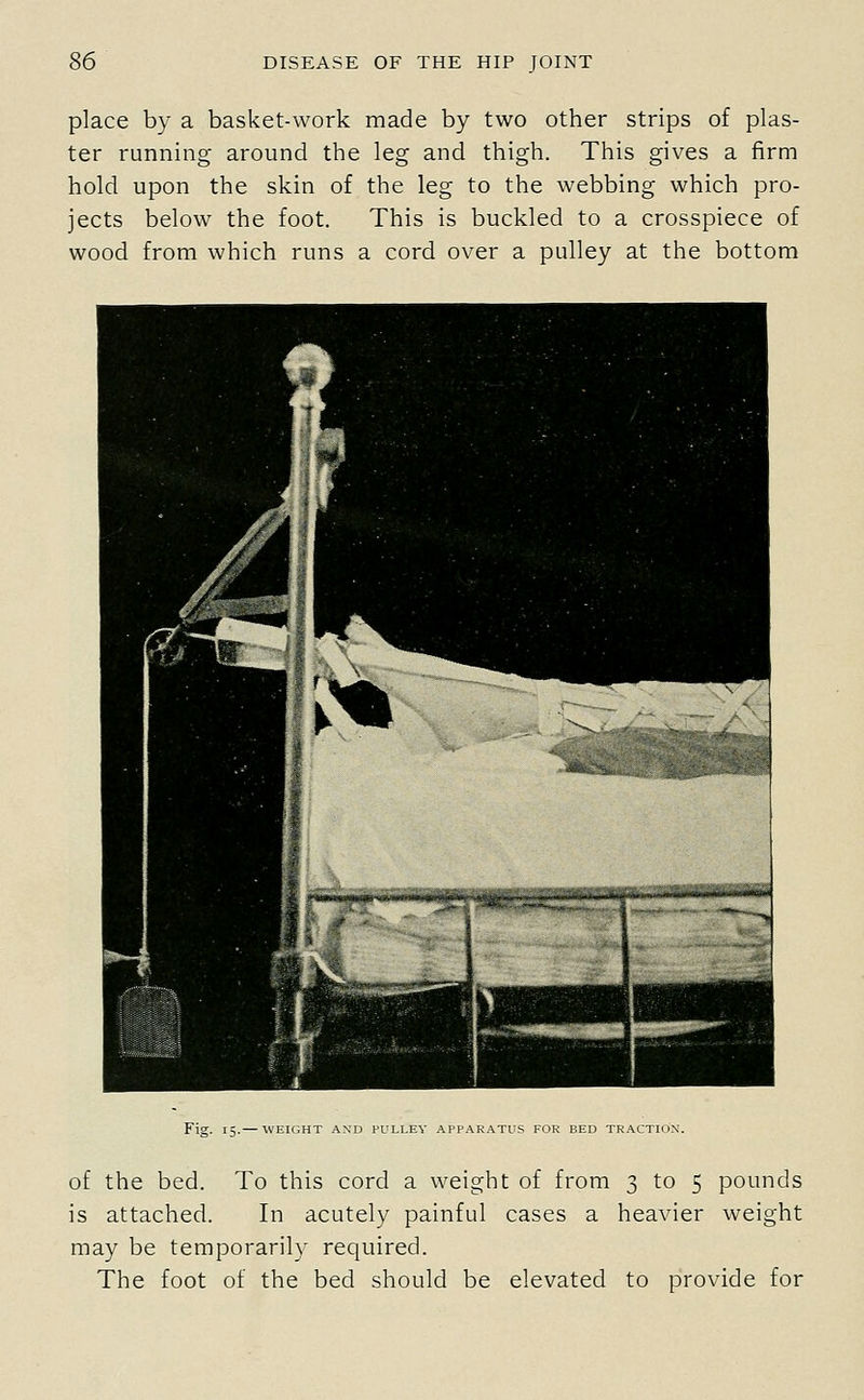 place by a basket-work made by two other strips of plas- ter running around the leg and thigh. This gives a firm hold upon the skin of the leg to the webbing which pro- jects below the foot. This is buckled to a crosspiece of wood from which runs a cord over a pulley at the bottom Fig. 15.— WEIGHT AXD PULLEY APPARATUS FOR BED TRACTION'. of the bed. To this cord a weight of from 3 to 5 pounds is attached. In acutely painful cases a heavier weight may be temporarily required. The foot of the bed should be elevated to provide for