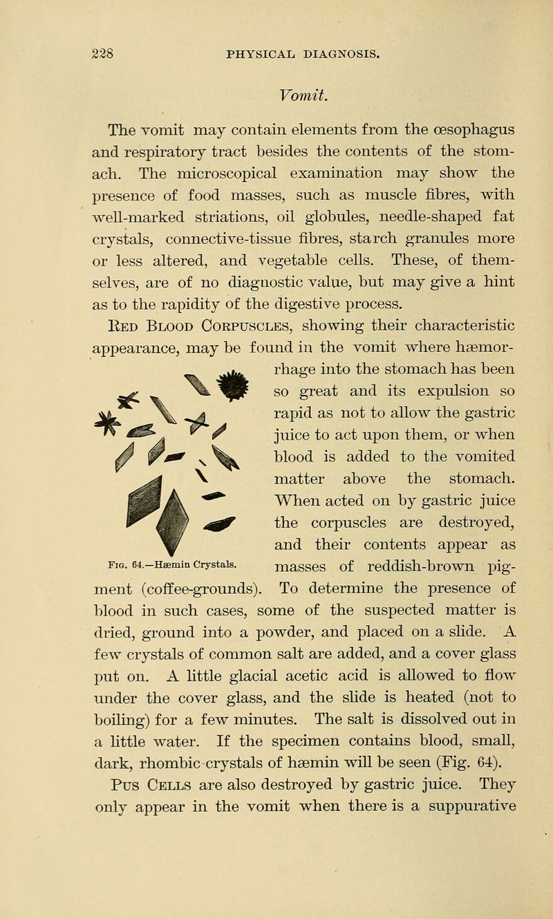 Vomit. The vomit may contain elements from the oesophagus and respiratory tract besides the contents of the stom- ach. The microscopical examination may show the presence of food masses, such as muscle fibres, with well-marked striations, oil globules, needle-shaped fat crystals, connective-tissue fibres, starch granules more or less altered, and vegetable cells. These, of them- selves, are of no diagnostic value, but may give a hint as to the rapidity of the digestive process. Bed Blood Corpuscles, showing their characteristic appearance, may be found in the vomit where haemor- rhage into the stomach has been so great and its expulsion so rapid as not to allow the gastric juice to act upon them, or when blood is added to the vomited matter above the stomach. When acted on by gastric juice the corpuscles are destroyed, and their contents appear as fig. 64.-Haemin crystals. masses of reddish-brown pig- ment (coffee-grounds). To determine the presence of blood in such cases, some of the suspected matter is dried, ground into a powder, and placed on a slide. A few crystals of common salt are added, and a cover glass put on. A little glacial acetic acid is allowed to flow under the cover glass, and the slide is heated (not to boiling) for a few minutes. The salt is dissolved out in a little water. If the specimen contains blood, small, dark, rhombic crystals of haemin will be seen (Fig. 64). Pus Cells are also destroyed by gastric juice. They only appear in the vomit when there is a suppurative