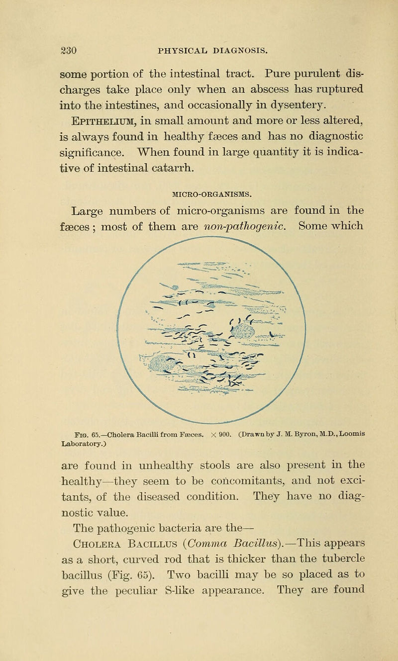 some portion of the intestinal tract. Pure purulent dis- charges take place only when an abscess has ruptured into the intestines, and occasionally in dysentery. Epithelium, in small amount and more or less altered, is always found in healthy faeces and has no diagnostic significance. When found in large quantity it is indica- tive of intestinal catarrh. MICRO-ORGANISMS. Large numbers of micro-organisms are found in the fasces ; most of them are non-pathogenic. Some which Fig. 65.—Cholera Bacilli from Fasces. X 900. (Drawn by J. M. Byron, M.D., Loomis Laboratory.) are found in unhealthy stools are also present in the healthy—they seem to be concomitants, and not exci- tants, of the diseased condition. They have no diag- nostic value. The pathogenic bacteria are the— Cholera Bacillus {Comma Bacillus).—This appears as a short, curved rod that is thicker than the tubercle bacillus (Fig. 65). Two bacilli may be so placed as to give the peculiar S-like appearance. They are found