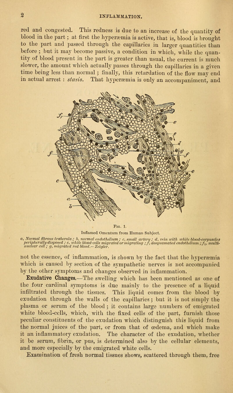 red and congested. This redness is due to an increase of the quantity of blood in the part; at first the liypertemia is active, that is, blood is brought to the part and passed through the capillaries in larger quantities than before ; but it may become passive, a condition in which, while the quan- tity of blood present in the part is greater than usual, the current is much slower, the amount which actually passes through the capillaries in a given time being less than normal; finally, this retardation of the flow may end in actual arrest : stasis. That hyperaemia is only an accompaniment, and Fig. 1. Inflamed Omentum from Human Subject. a, Normal fibrous trabecula; b, normal endothelium,; c, small artery; d, vein with while blood-corpusdes peripherally disposed ; «, white blood-cells migrated or migrating ;/, desq^uamated endothelium ,-/,, muUi- miclear cell; g, migrated red blood.— Zeigler. not the essence, of inflammation, is shown by the fact that the hyperaemia which is caused by section of the sympathetic nerves is not accompanied by the other symptoms and changes observed in inflammation. Exudative Changes.—The swelling which has been mentioned as one of the four cardinal symptoms is due mainly to the presence of a liquid infiltrated through the tissues. This liquid comes from the blood by exudation through the walls of the capillaries; but it is not simply the plasma or serum of the blood ; it contains large numbers of emigrated white blood-cells, which, with the fixed cells of the part, furnish those peculiar constituents of the exudation which distinguish this liquid from the normal juices of the part, or from that of oedema, and which make it an inflammatory exudation. The character of the exudation, whether it be serum, fibrin, or pus, is determined also by the cellular elements, and more especially by the emigrated white cells. Examination of fresh normal tissues shows, scattered through them, free