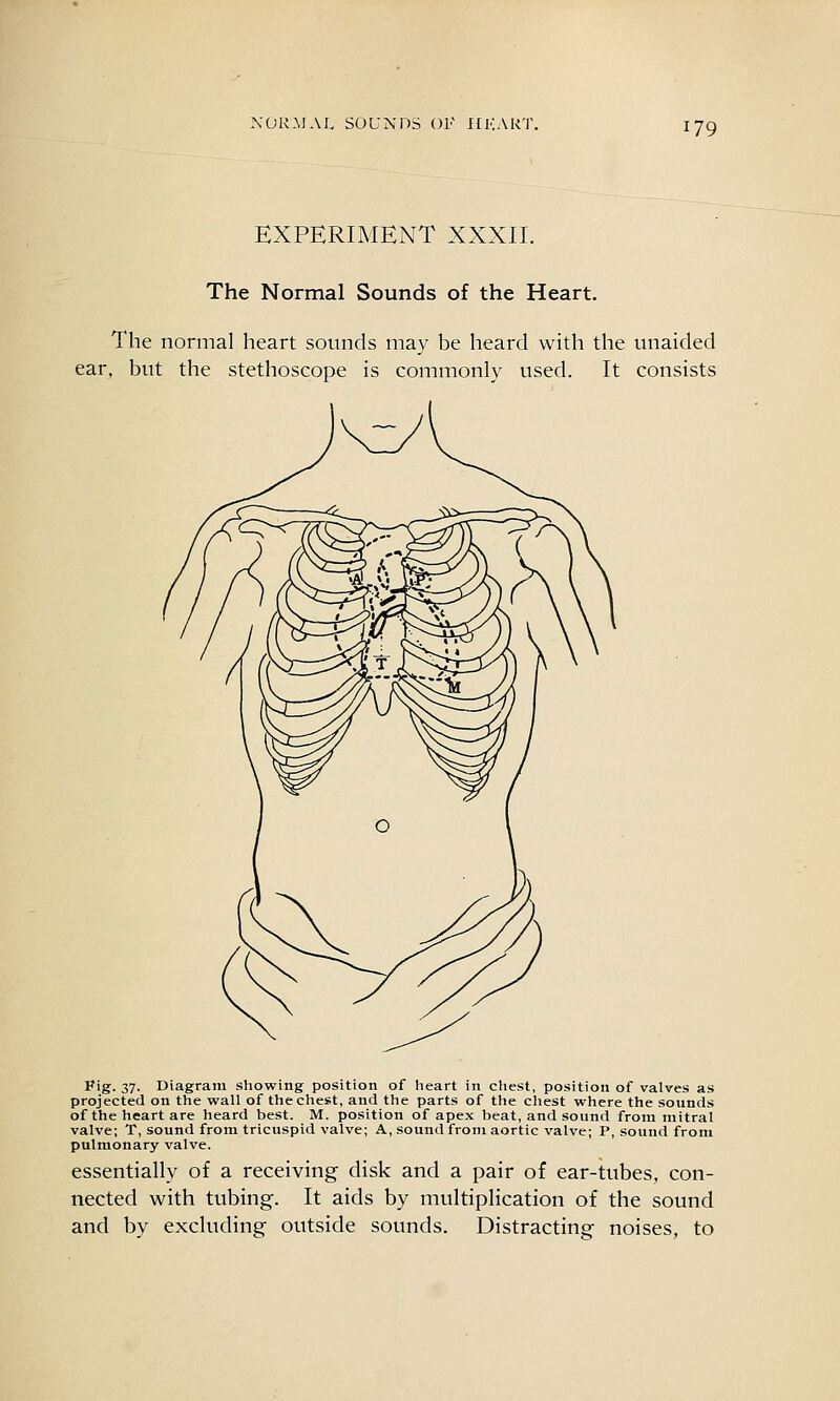 EXPERIMENT XXXII. The Normal Sounds of the Heart. The normal heart sounds may be heard with the unaided ear, but the stethoscope is commonly used. It consists Fig. 37. Diagram showing position of heart in cliest, position of valves as projected on the wall of the chest, and the parts of the chest where the sounds of the heart are heard best. M. position of apex beat, and sound from mitral valve; T, sound from tricuspid valve; A, sound from aortic valve; P, sound from pulmonary valve. essentially of a receiving disk and a pair of ear-tubes, con- nected with tubing. It aids by multiplication of the sound and by excluding outside sounds. Distracting noises, to