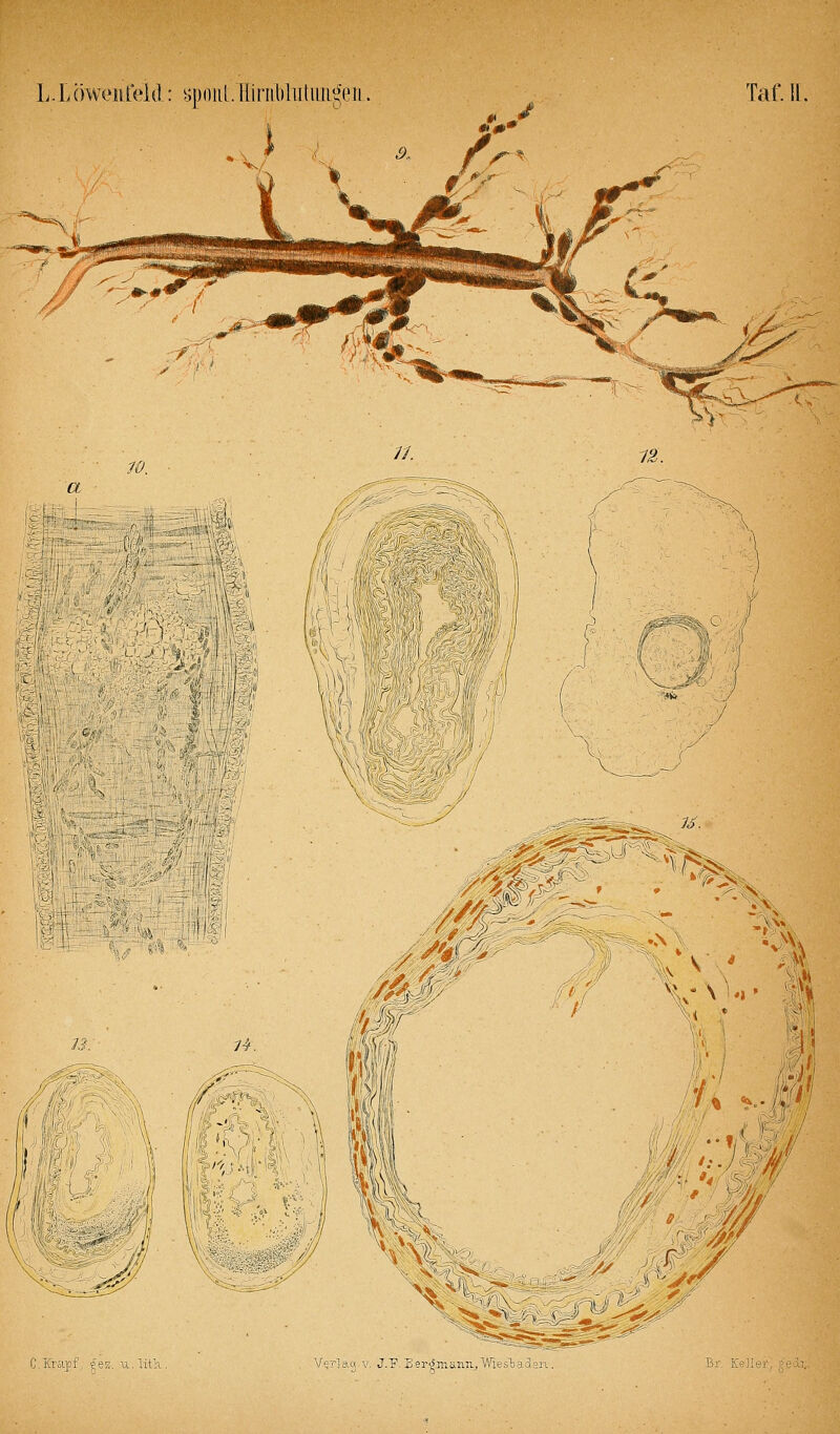 L.LÖweiifeid: «poiii. liiriibliitiuigeiL Taf. IL //. 12,. % m ^j\ J6 ■/ Mi'*' '■ ß C.Krapf, ijex. u.lita. Verla« V JP Lei5nwnii,Wi-