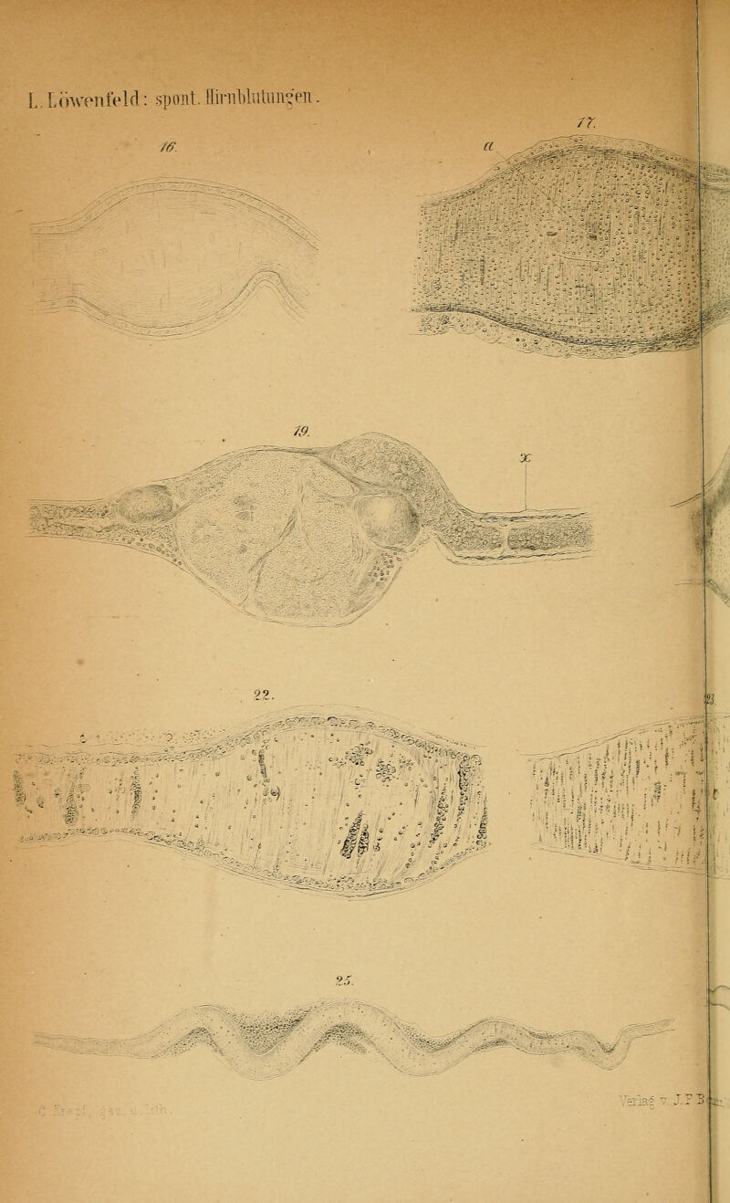 L. l(iM'pntVld: spoiit. [Iinil)luliiii?pn. m f/t' ia*v J.FBi