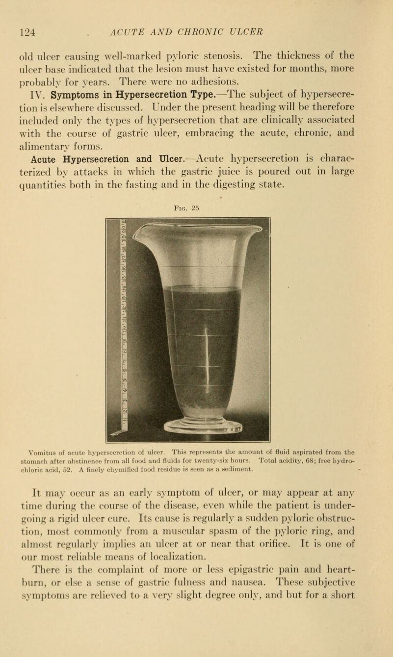 old ulcer causing well-marked pyloric stenosis. The thickness of the ulcer base indicated that the lesion must have existed for months, more jjrohahly for years. There were no adhesions. IV. Symptoms in Hypersecretion Type.—The subject of hypersecre- tion is elsewhere discussed. Under the present heading will be therefore included only the t>pes of hypersecretion that are clinically associated with the course of gastric ulcer, embracing the acute, chronic, and alimentary forms. Acute Hypersecretion and Ulcer.—Acute hypersecretion is charac- terized by attacks in which the gastric juice is poured out in large quantities both in the fasting and in the digesting state. Fig. 25 Vomitus of acute hypersecretion of ulcer. This represents the amount of fluid aspirated from the stomach after abstinence from all food and fluids for twenty-six hours. Total acidity, 68; free hydro- chloric acid, 52. A finely chymified food residiie is seen as a sediment. It may occur as an early symptom of ulcer, or may apjx'ar at any time during the course of the disease, e\cn while the i)atieiit is under- going a rigid ulcer cure. Its cause is regularly a sudden jjyloric obstruc- tion, most commonly from a muscular spasm of th(> ])ylori(' ring, and almost regularly implies an ulcer at or near that orifice. It is one of our most relialde means of localization. There is the complaint of more or less e])igastric ])ain and heart- burn, or else a sense of gastric fulness and nausea. These subjective symptoms are relieved t(^ a very slight degree only, and but for a short